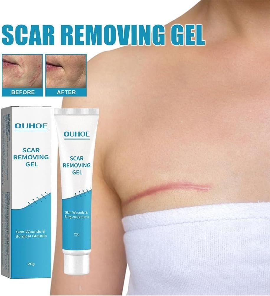 Bayer Consumer Care - Bayer Biseptine Roll Scars Remodeling 20g