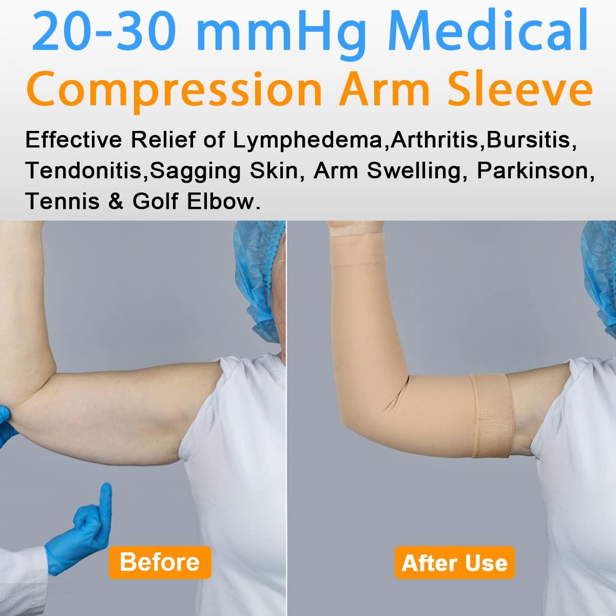 Normers 2030 mmHg Medical Lymphedema Compression Arm Sleeve for Men