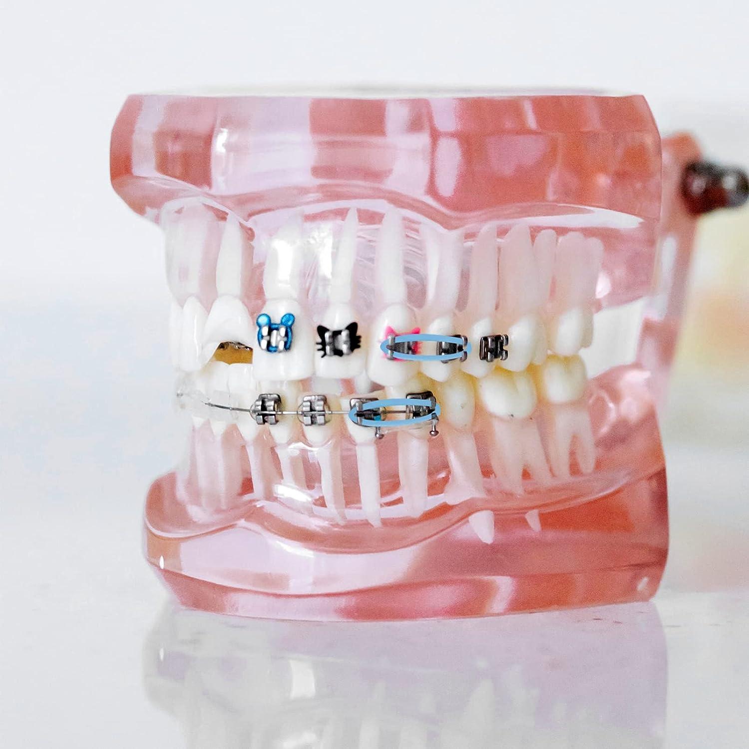 Orthodontic Braces Rubber Bands Power Chains, Elastic Chains, Flex Colored Bands