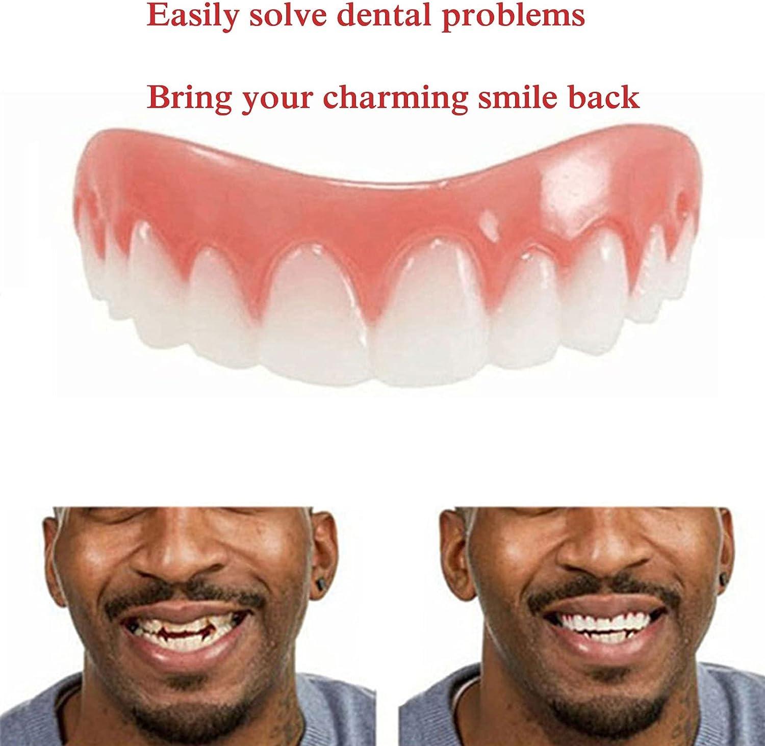 Adjustable SnapOn Dentures, 2023 New SnapOn Dentures, Dental Veneers