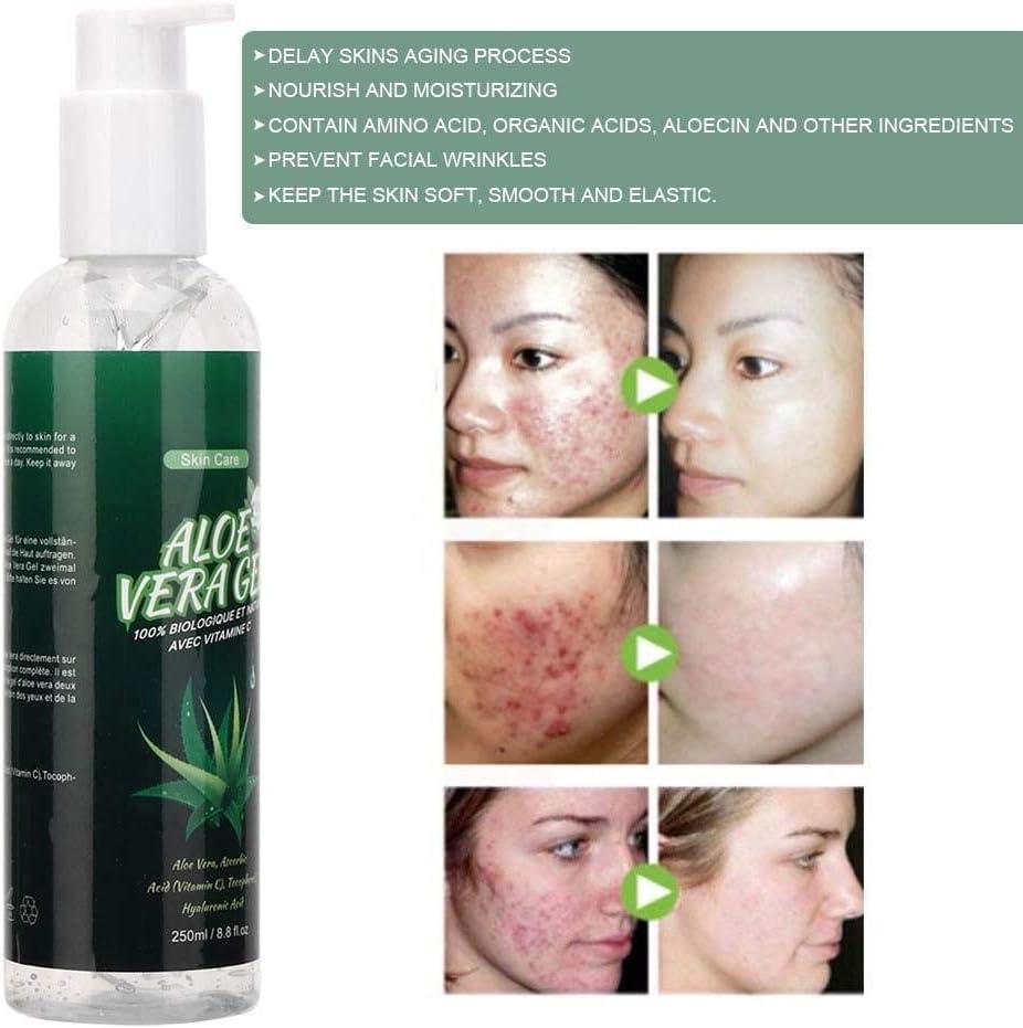 250ml Aloe Vera Gel Moisturizing and Anti wrinkle Cream Repair of Whitening  Scar Sunscreen Aloe Gel Soothing and Moisturizing Facial Skin for face body  sunburn and Dry | Buy Now with Express