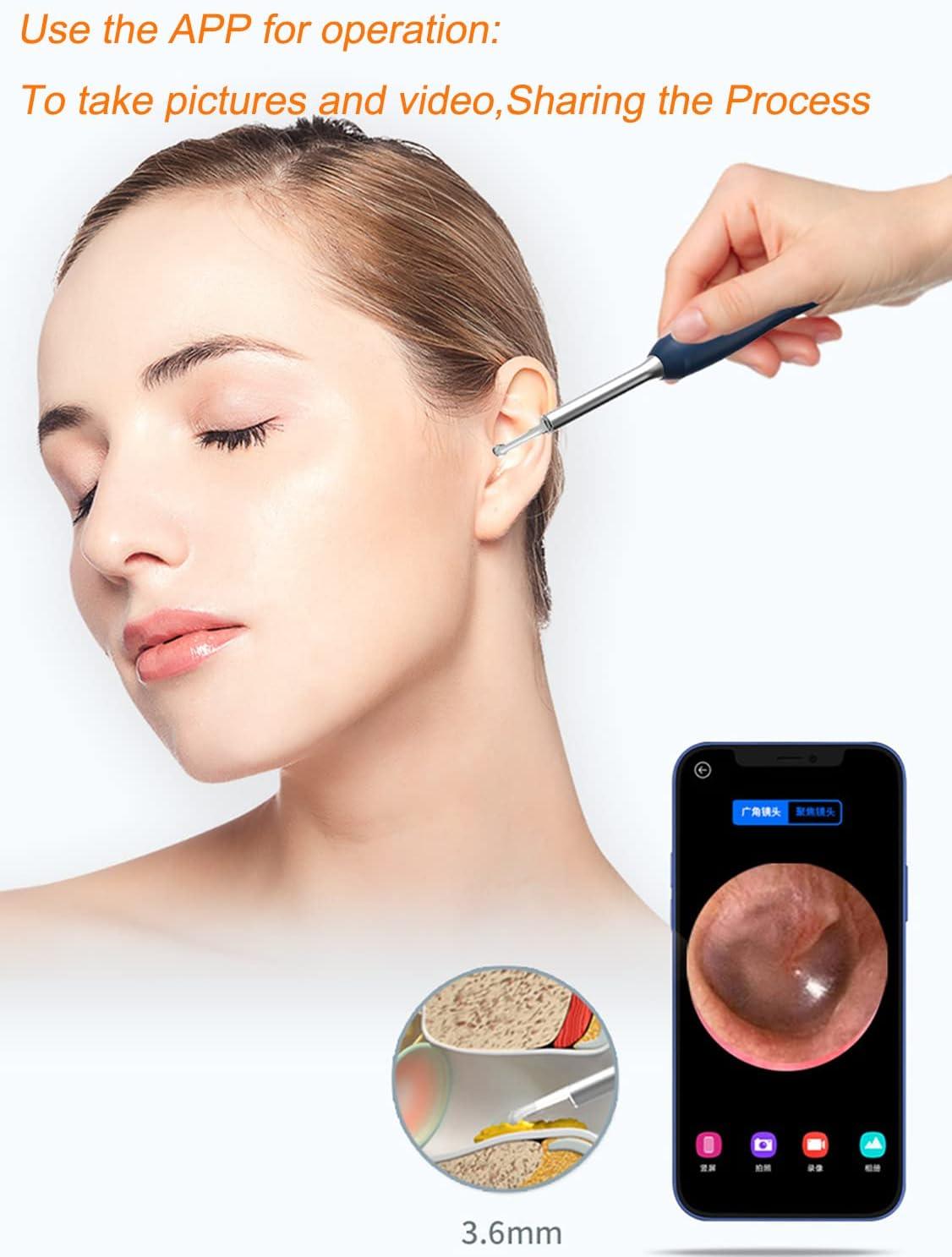 Wireless Ear Wax Removal Endoscope with 1080P FHD Camera and 6 LED