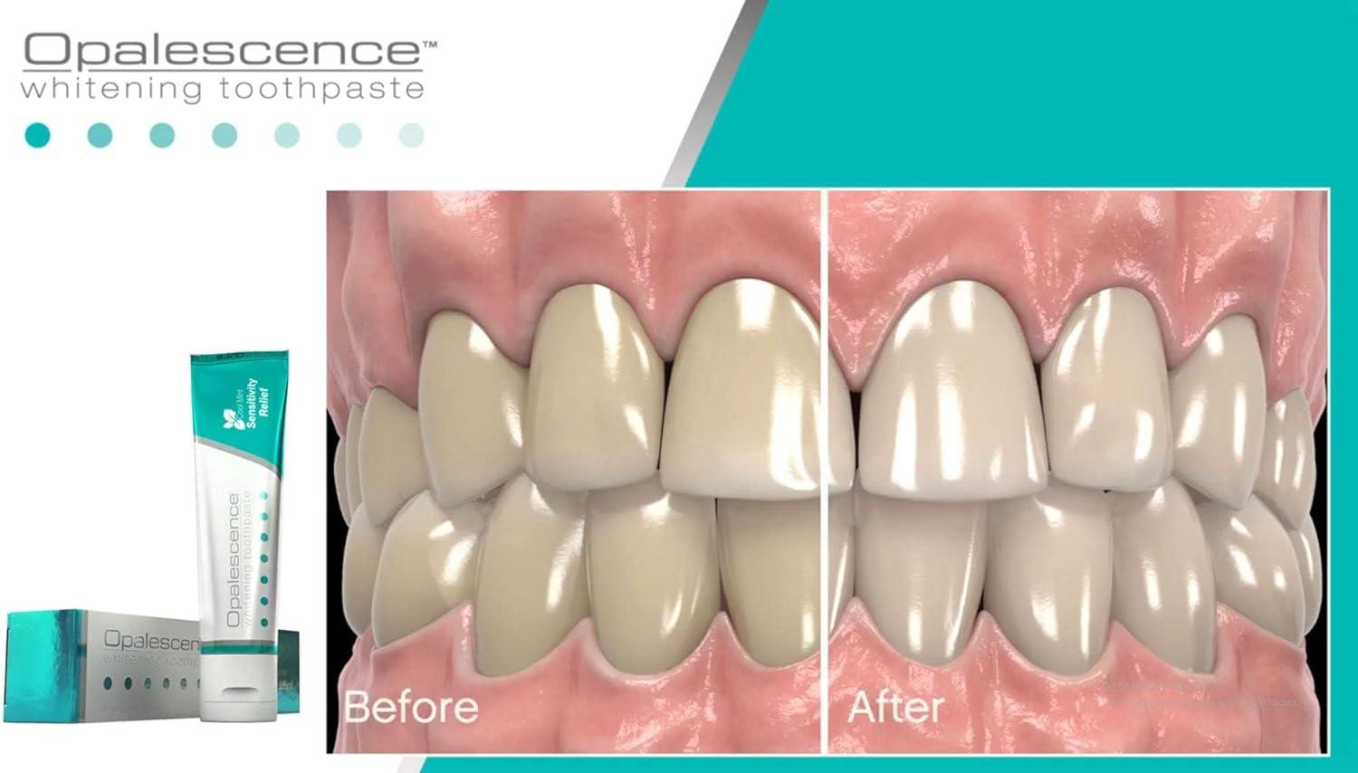 Opalescence Sensitivity Relief Whitening Toothpaste Intense Whitening