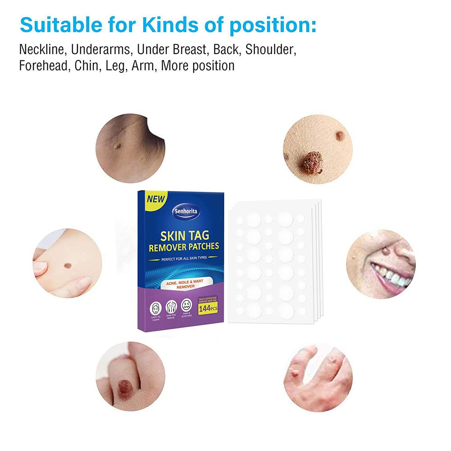 Skin Tag Remover Patches 144Pcs Safe & Painless Wart Removal for Face & Body