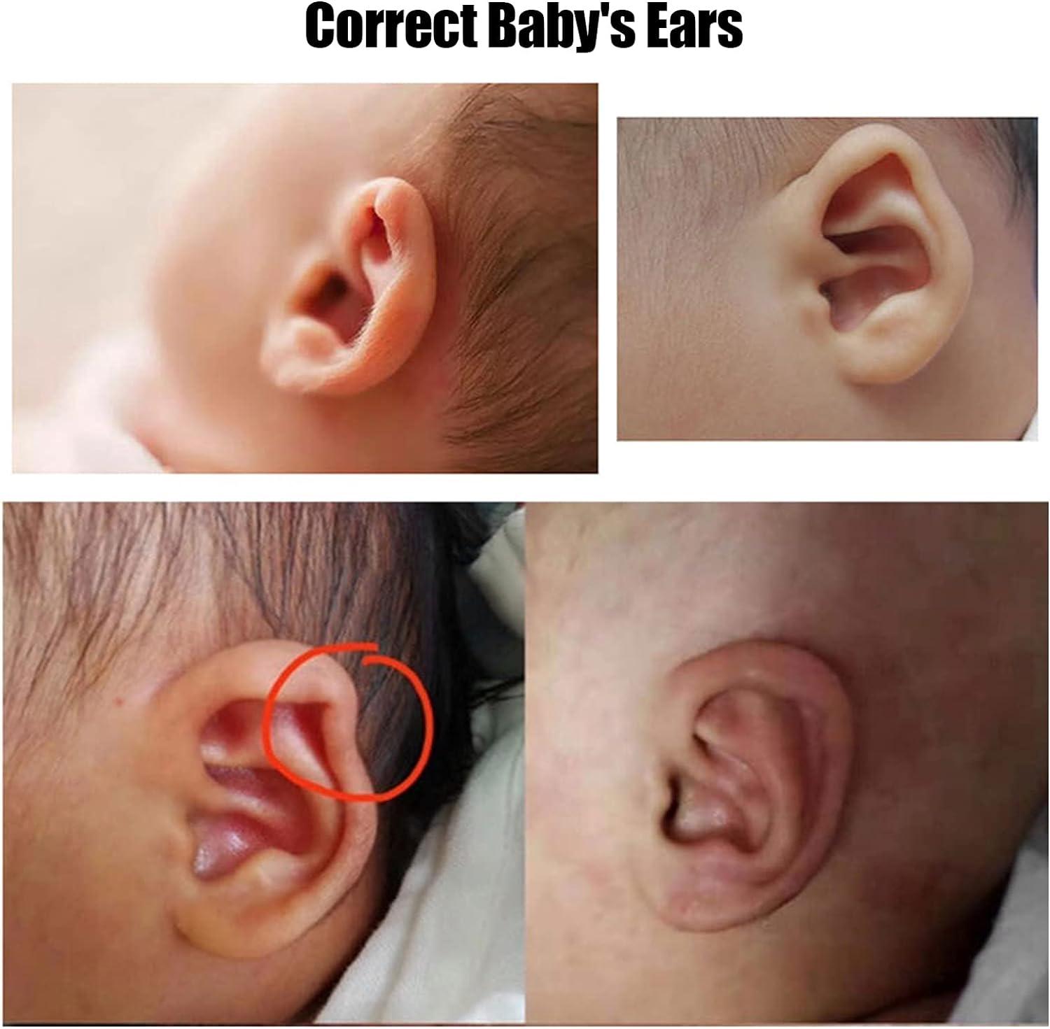 OHPHCALL 4 Rolls protruding Ear Correction Sticker protruding Ear Tape Ear  Aesthetic correctors Newborn Baby Health Ear Patch Baby Ear Tape Kid