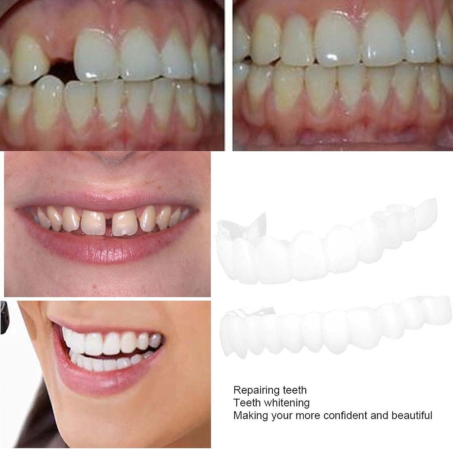 Smile Teeth Customizable Temporary Perfect Fake Teeth Molds Braces