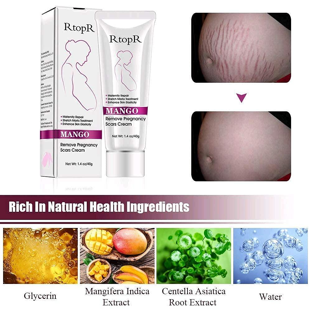RtopR Mango Stretch Marks & Scar Cream Pregnancy Safe Moisturizer