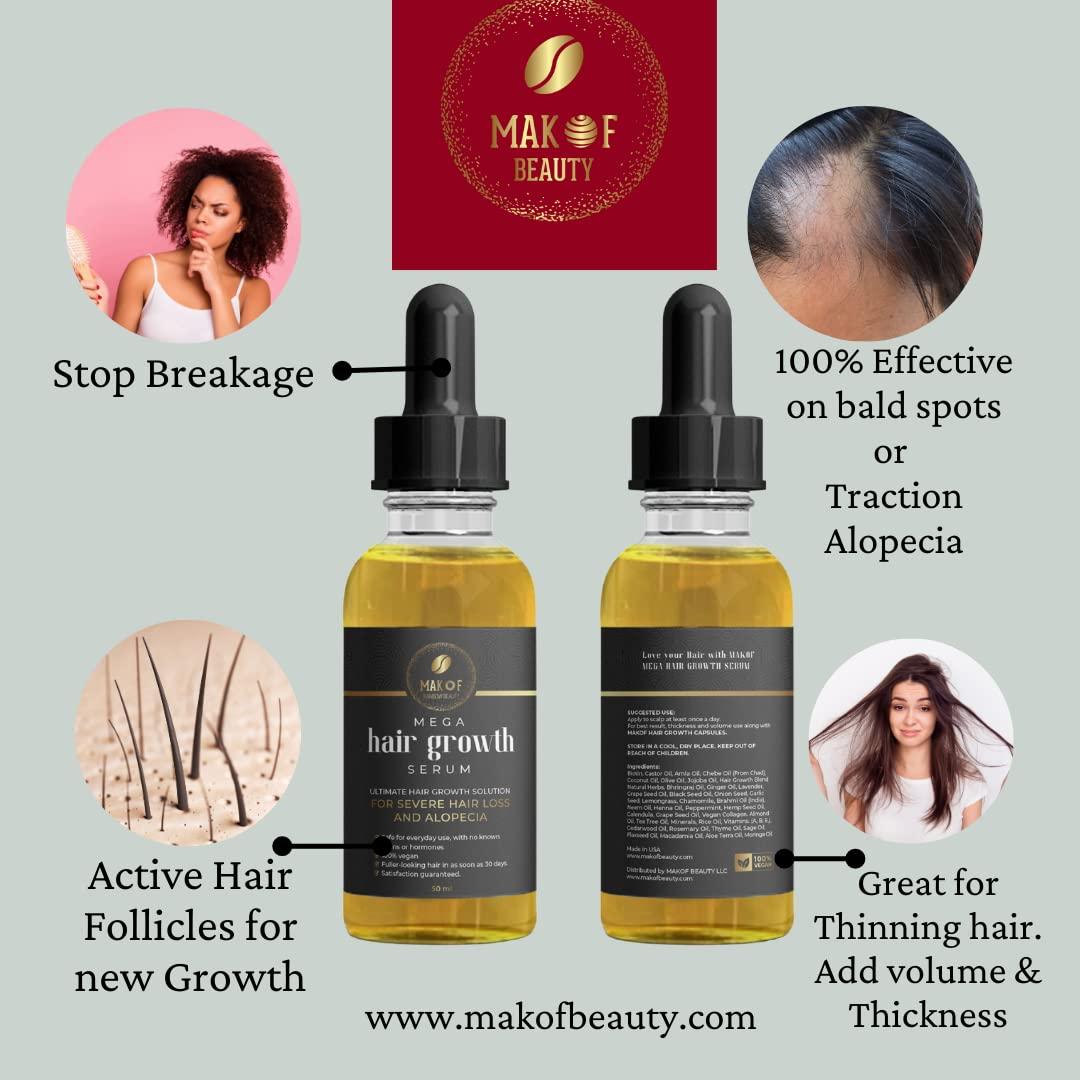 Style Alopecia GR+ サプリメント 30g Style Alopecia GR+ サプリメント 30g Amazon.com : Alopecia Amazing