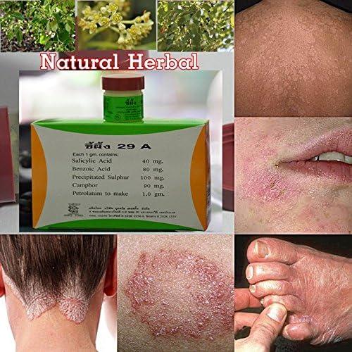 100 Natural Herb Cream Cure Eczema Dermatitis Psoriasis 3x7.5g (29 A WAX)