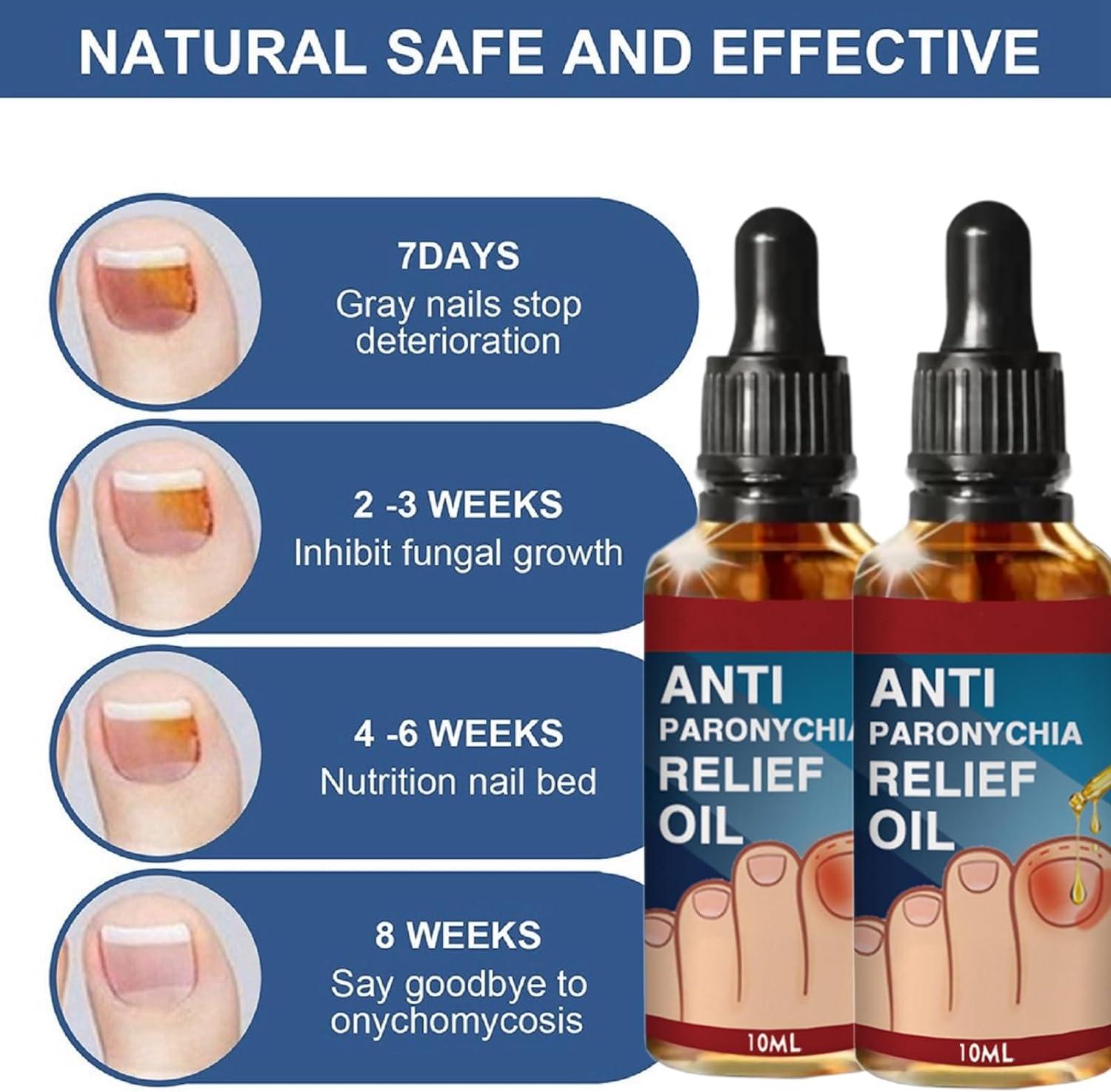 2PCS Ingrown Toenail Treatment Anti Paronychia Relief Oil Ingrowing