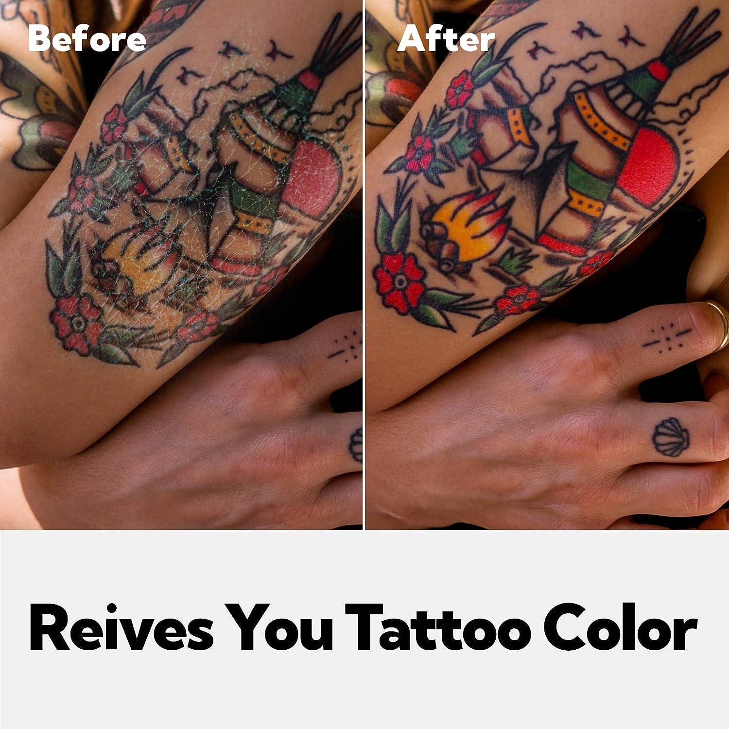 Techniques For Permanent Tattoo Removal Treatment | Kaya Skin Clinic UAE