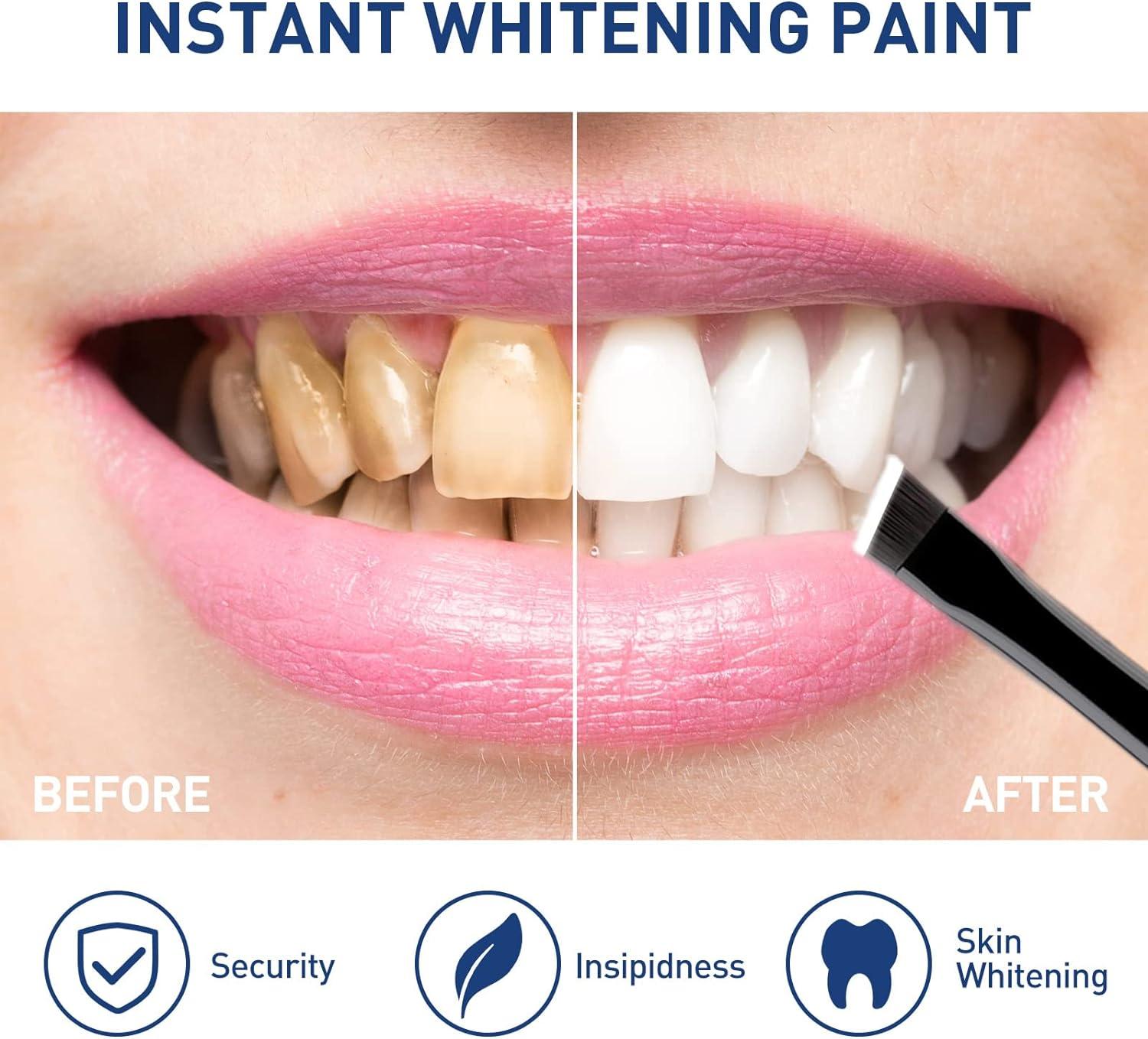 Instant Teeth Whitening Gel for Sensitive Teeth Uptight White Tooth
