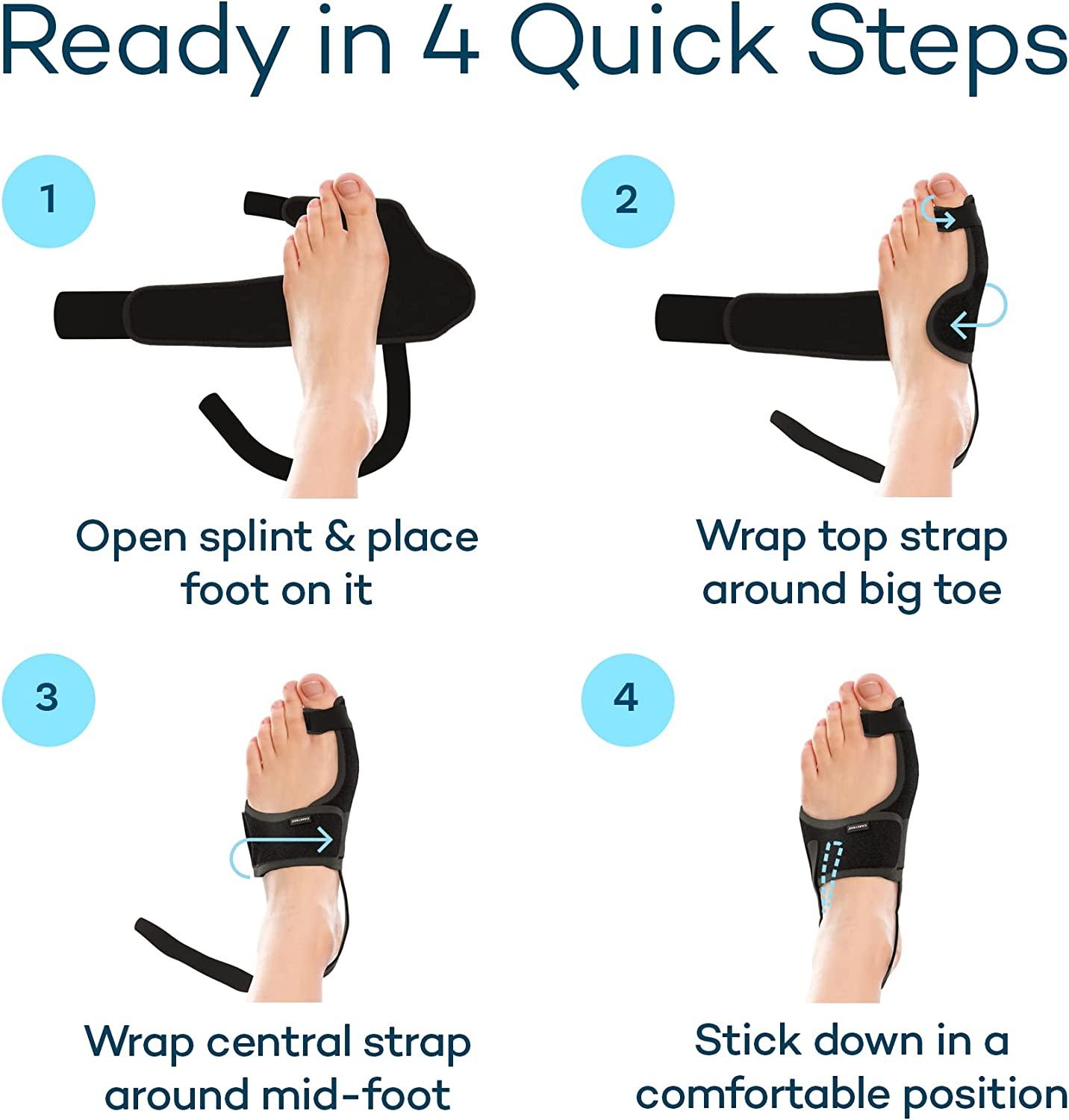 CARETRAS Bunion Corrector Set for Women & Men Orthopedic Splint for