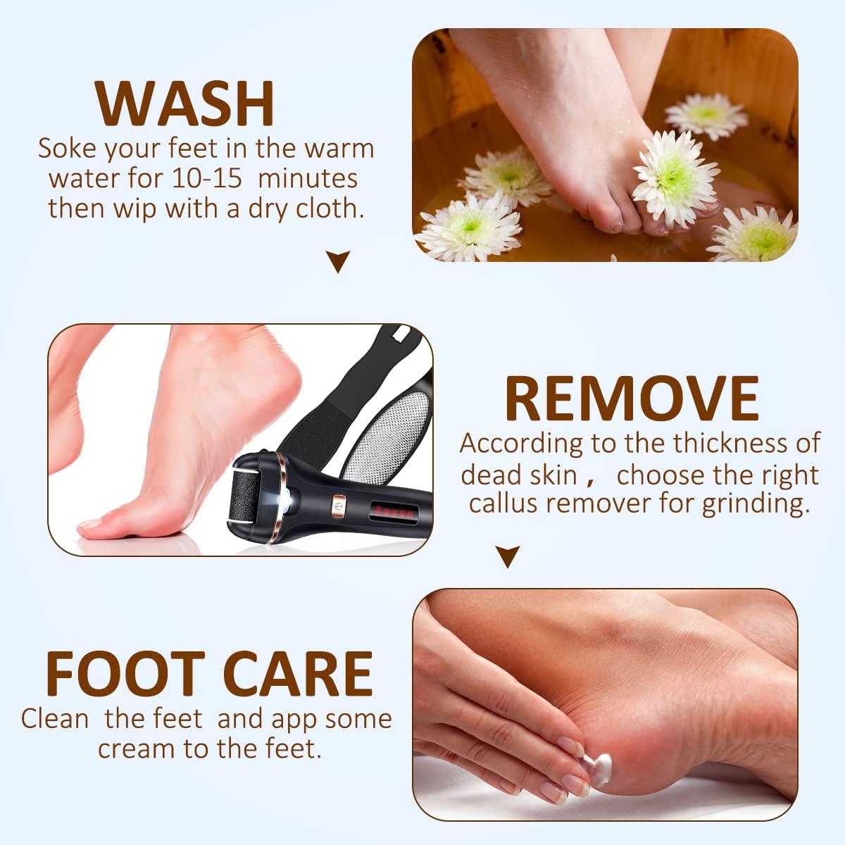 Electric Callus Remover for Feet Rechargeable Foot File Hard Skin