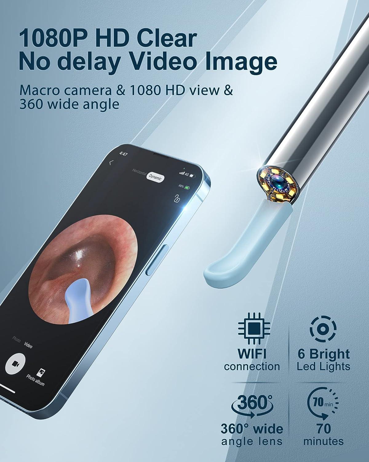 1080P Ear Wax Removal Camera Kit for iPhone, iPad & Android Includes
