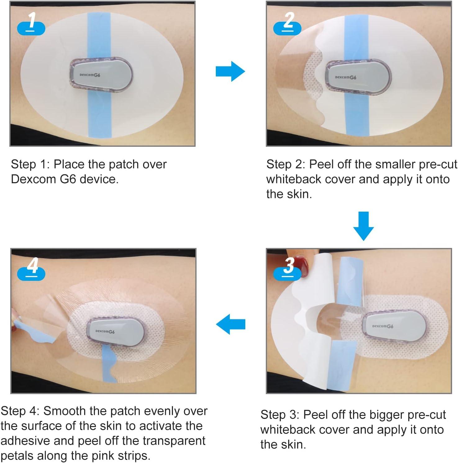 Kuruyo Adhesive Patches for Dexcom G6 Sensor Covers Overpatch