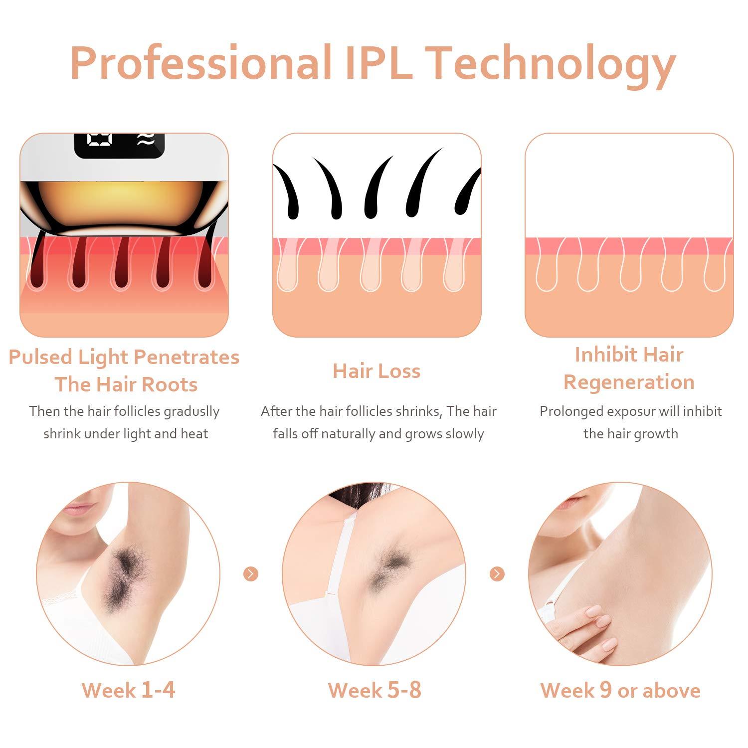At-Home IPL Hair Removal for Women and Men,Laser Hair Removal 99,999  Flashes Painless Hair Remover for Facial Legs Arms Armpits Whole Body  Treatment WHITE