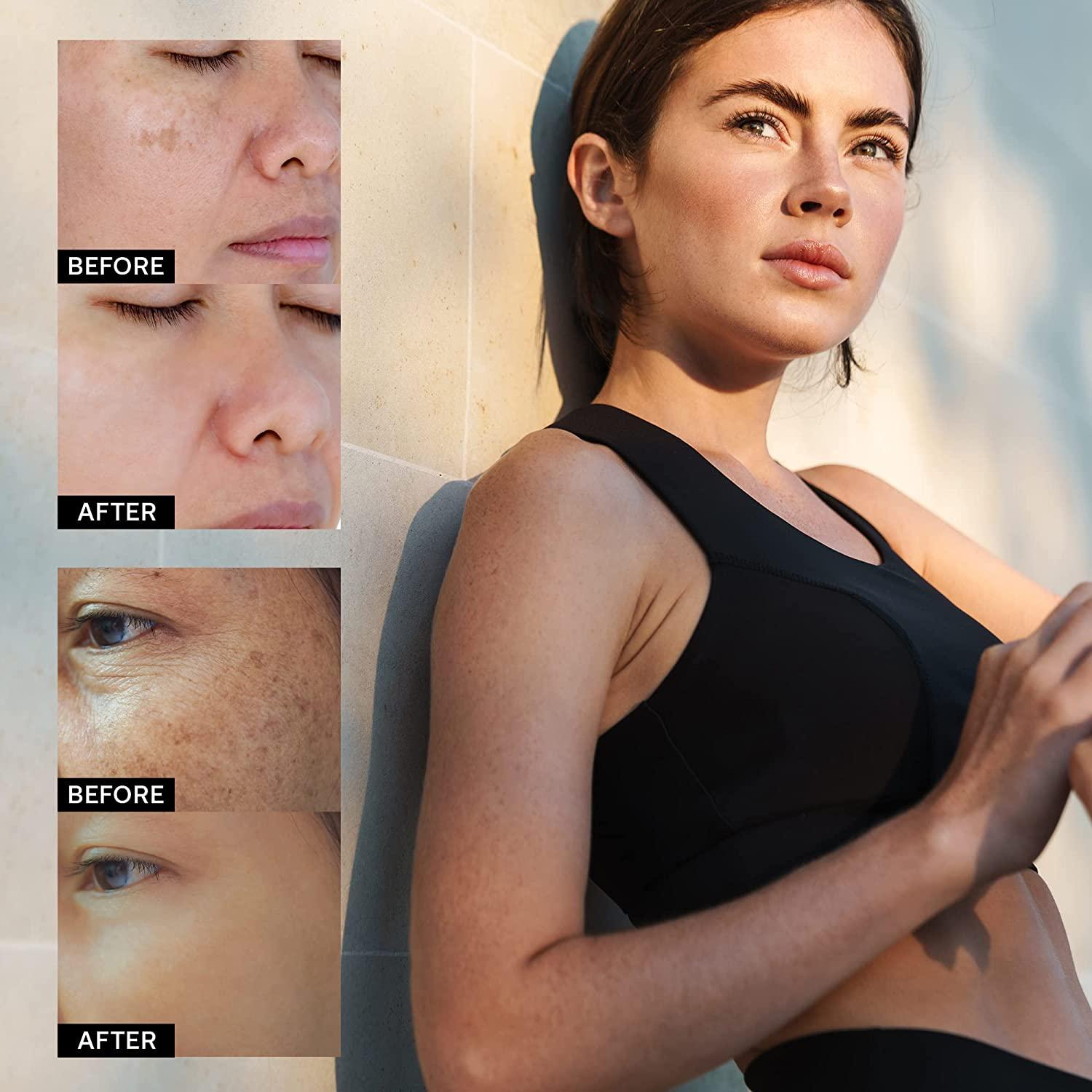 aobbiy glutathione dark spot corrector AOBBIY Hyperpigmentation Treatment â€“ Dark Spot Remover for Face & Body,  Niacinamide Serum for Melasma, Sun Spots, 1.01 Fl Oz main image 1