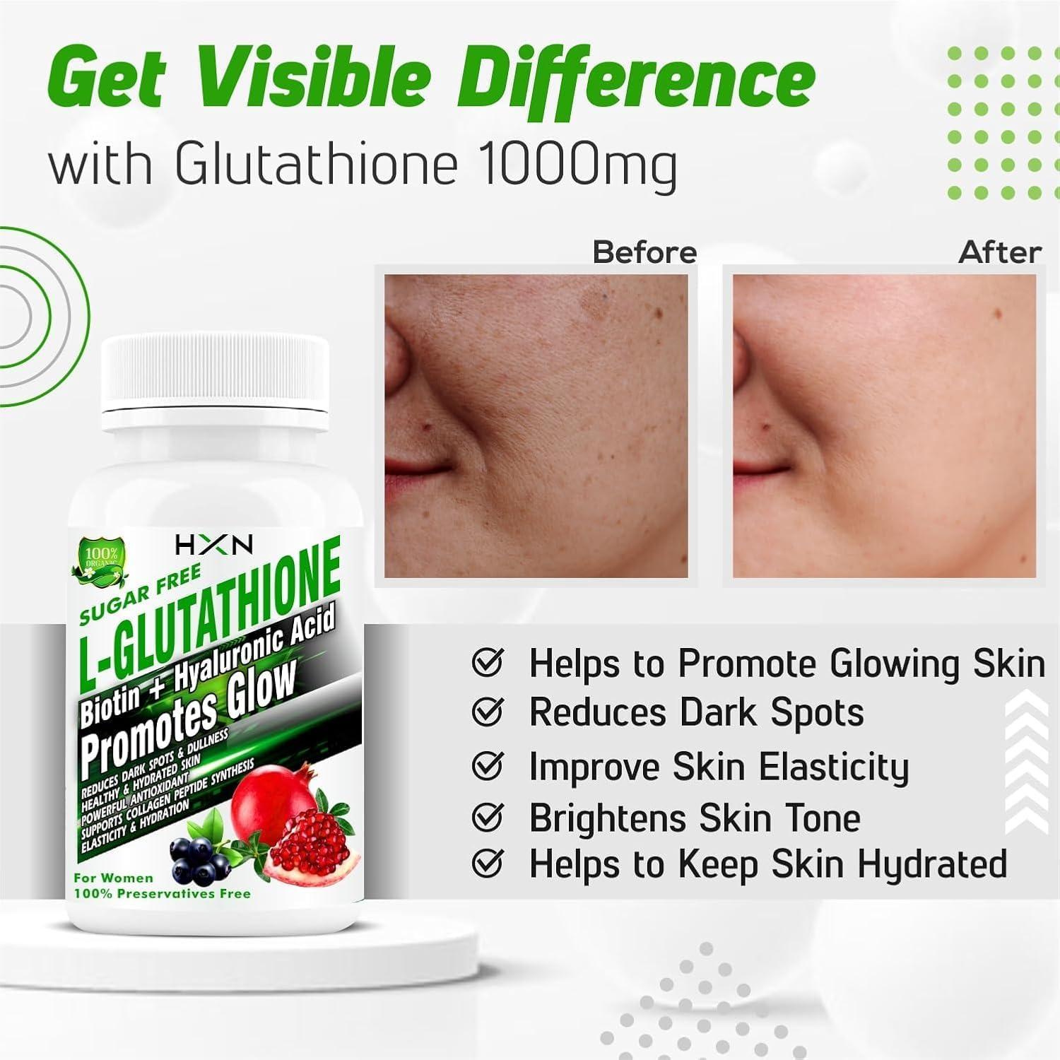 can glutathione cause hair loss Glutathione Tablets 1000mg For Skin Whitening. L-Glutathione Vitamin C E  Hyaluronic Acid ALA Biotin Collagen Supplements For Women Healthy Face-60  Glow Tablet (No Capsule/Capsules Pack 1)