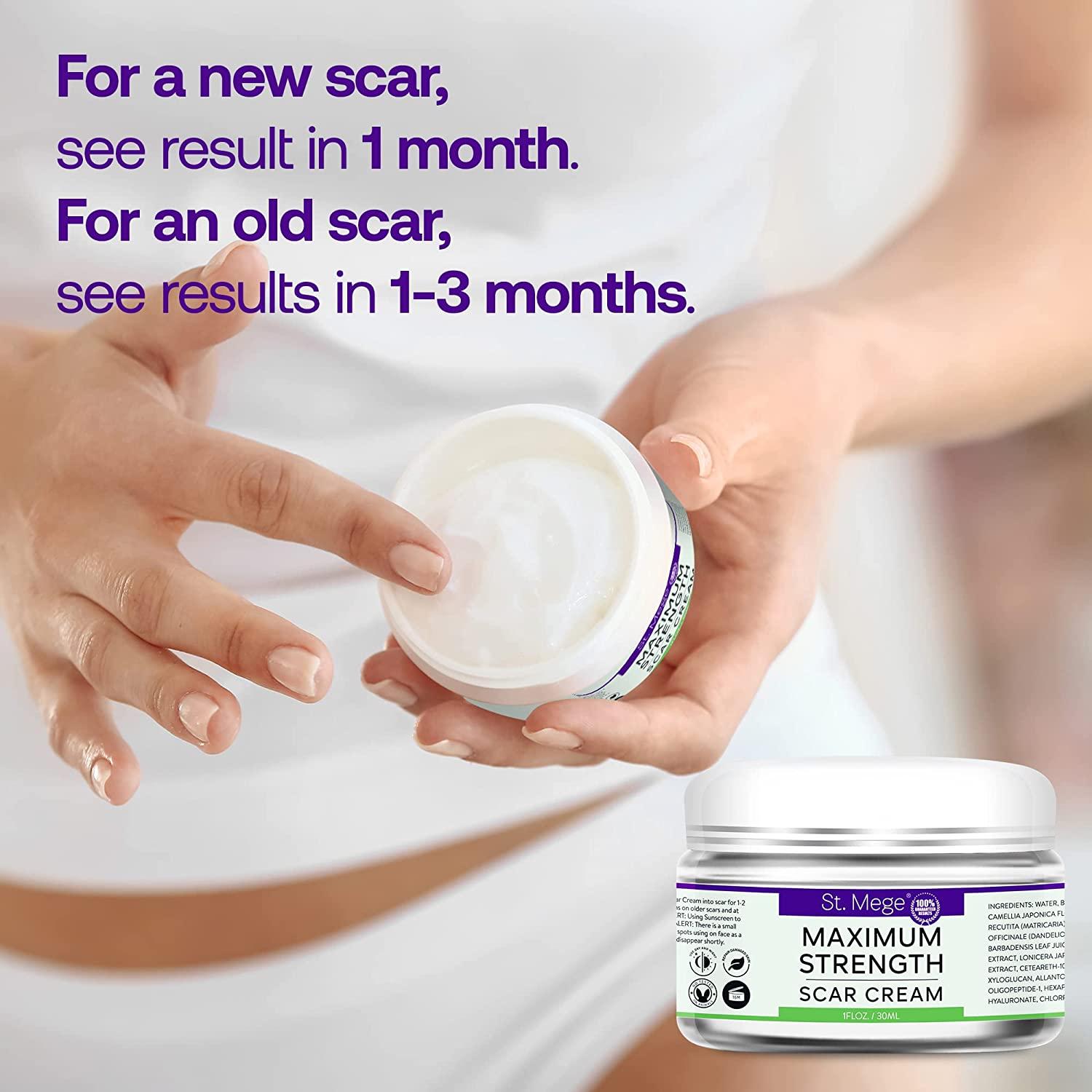 Scar Removal Cream - Advanced Scar Treatment Gel for Surgical Scars, Acne  Scars, C-Section, Burns, Stretch Marks -Effective for Old and New Scars :  Buy Online at Best Price in KSA -
