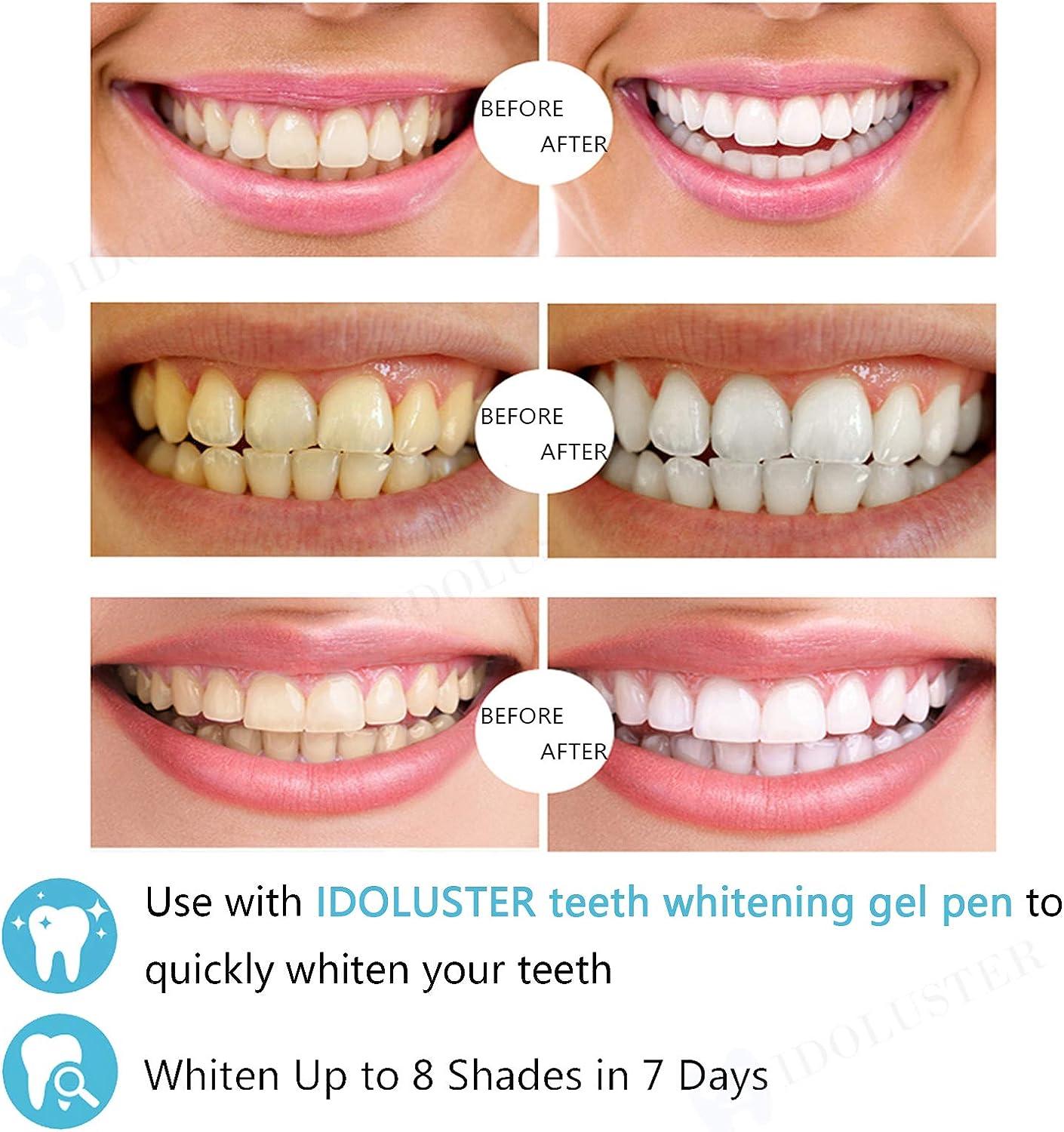 Teeth Whitening Uv Light At Home Shelly Lighting