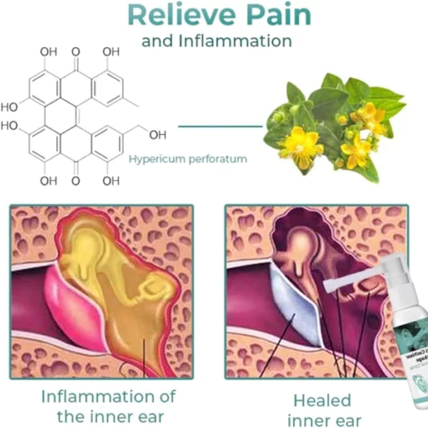 IEXUX Anti Cochlear Blockage Removal Spray Earwax Removal Spray Ear Wax