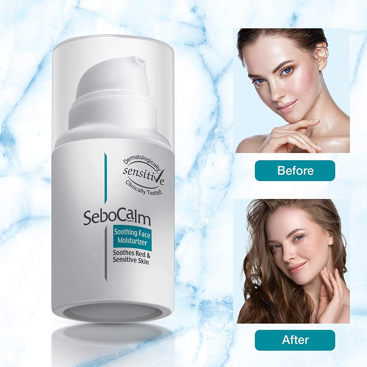 SeboCalm Redness Relief Face Moisturizer Hypoallergenic Vegan Cream