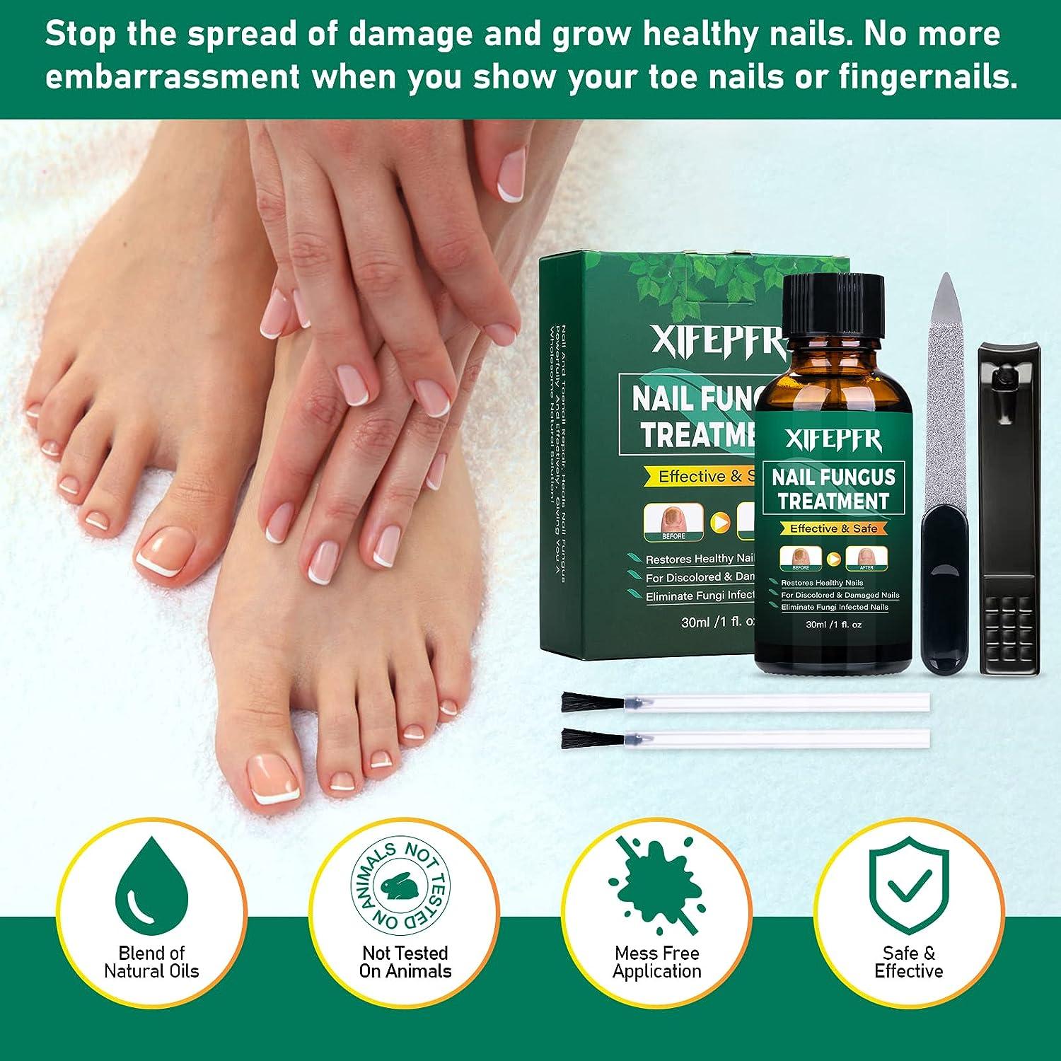 XIFEPFR Toenail Repair Treatment Extra Strength, Nail Repair Solution