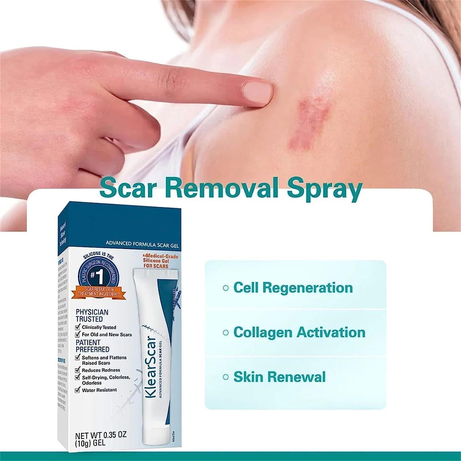 Klearscar Advanced Scar Removal Gel Scarremove Medical Grade Scar