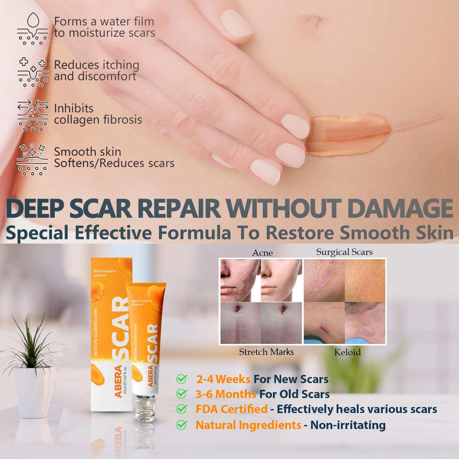Aichun Beauty Skin Repair Handy Scar Remove Anti Scar Removal cream With  SPF 30 Price in India - Buy Aichun Beauty Skin Repair Handy Scar Remove  Anti Scar Removal cream With SPF