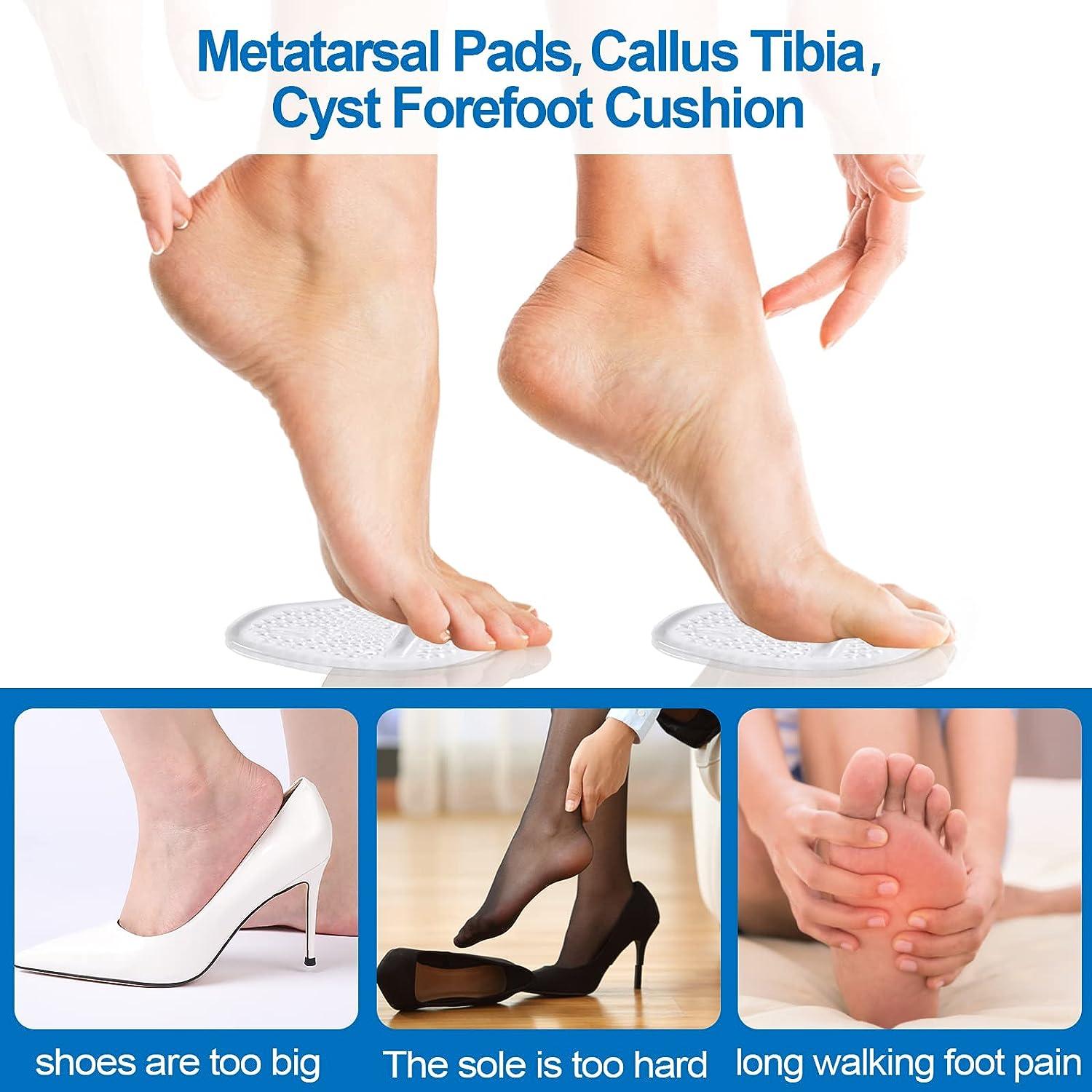 How To Prevent & Treat Feet Corns, Calluses & Cracked Heels