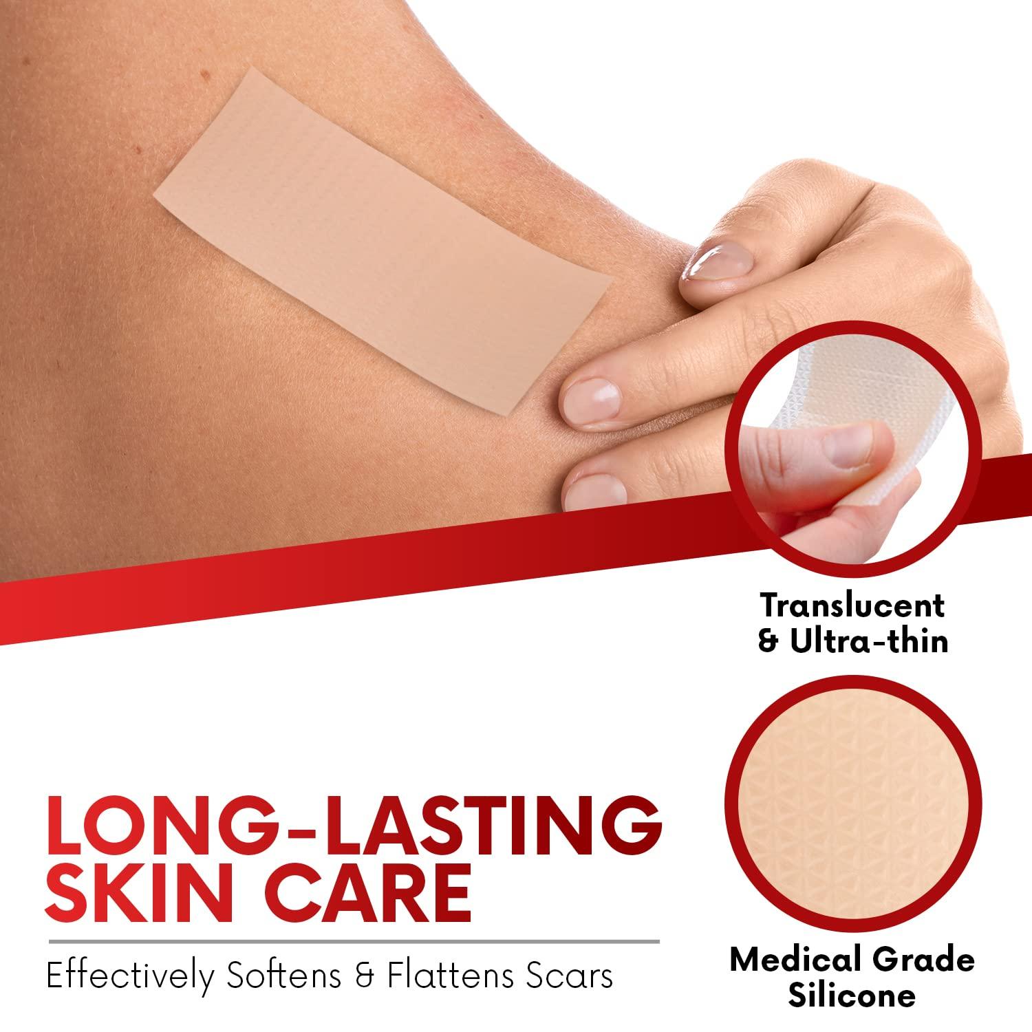 HEALQU Scar Sheets Roll Medical Grade Silicone Tape for Keloid