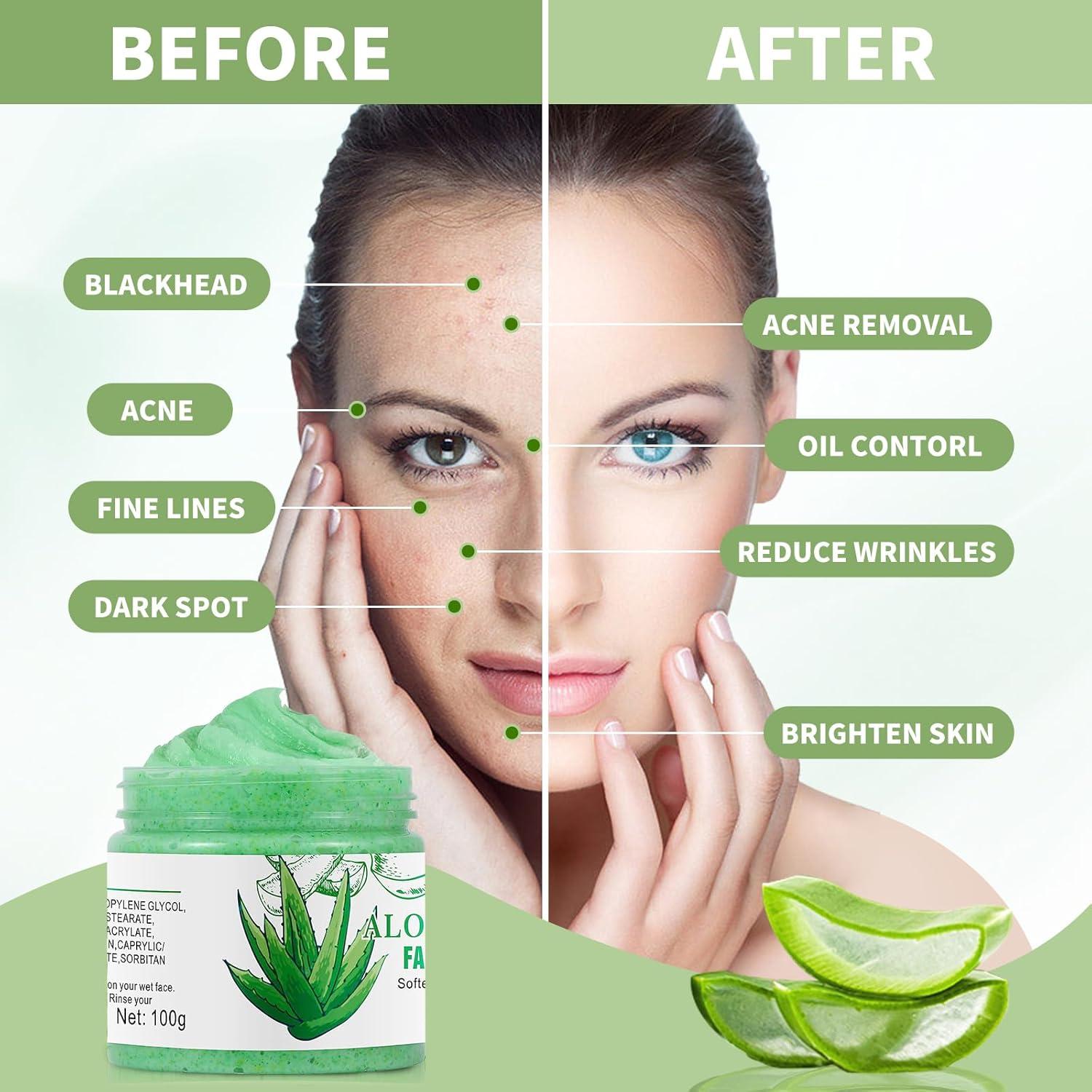 Brightening Aloe Vera Facial Scrub - Exfoliating Face Wash for Blackheads &  Dark Spots | Deep Cleansing Exfoliator