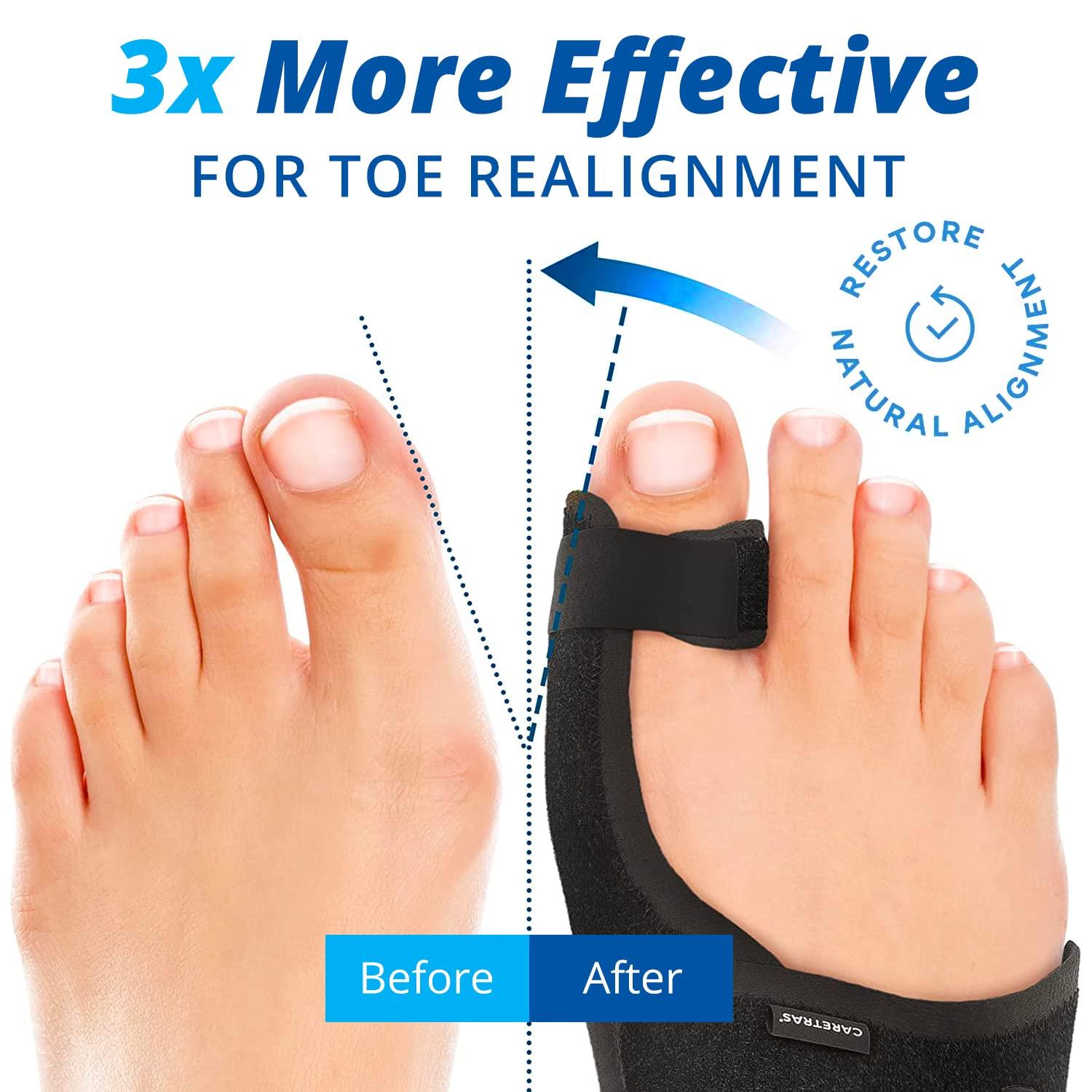 Wifamy Toe Separators Bunion Corrector Pain Relief Toe Spacers for
