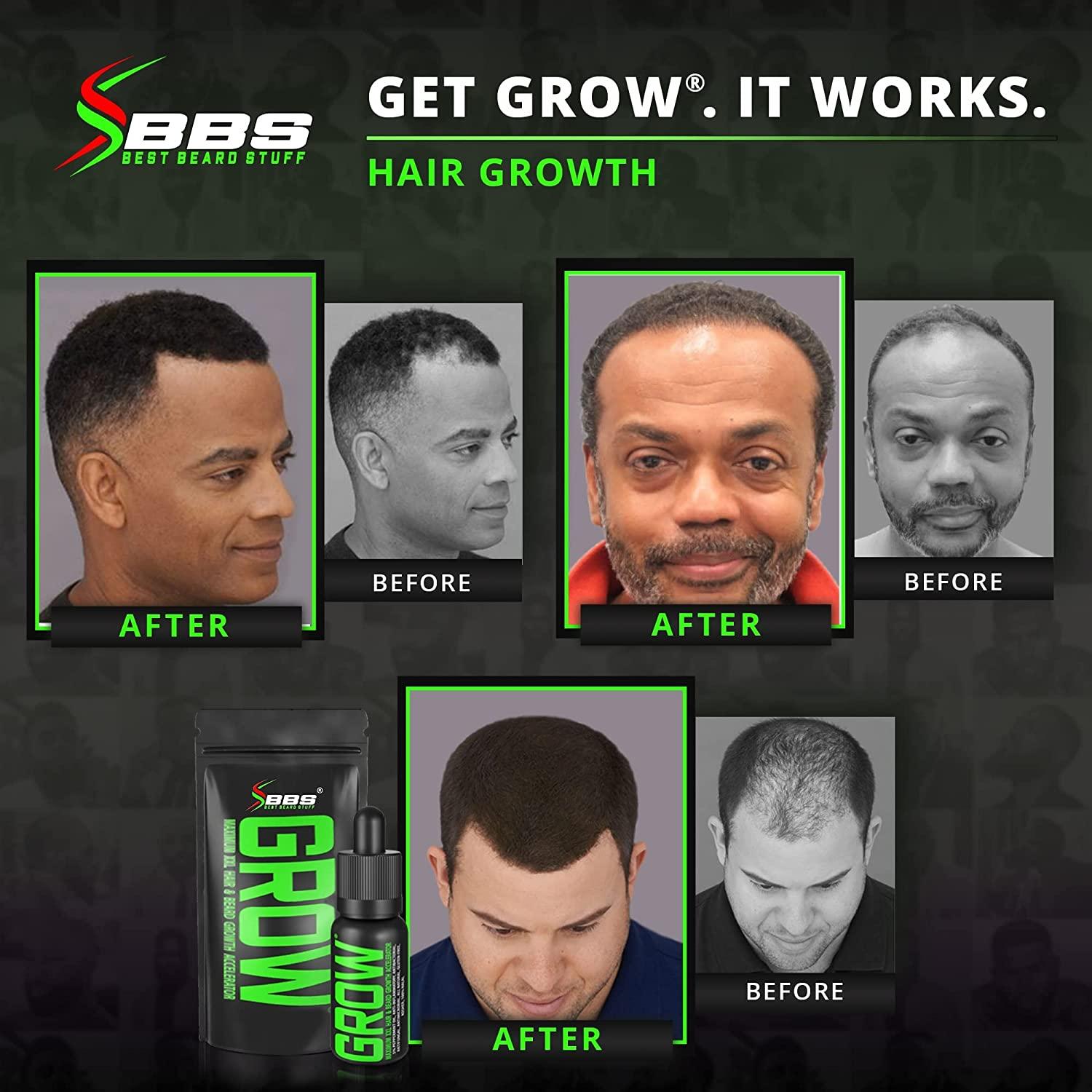 GROW Maximum XXL Hair & Beard Growth Oil for Men Fill Patches