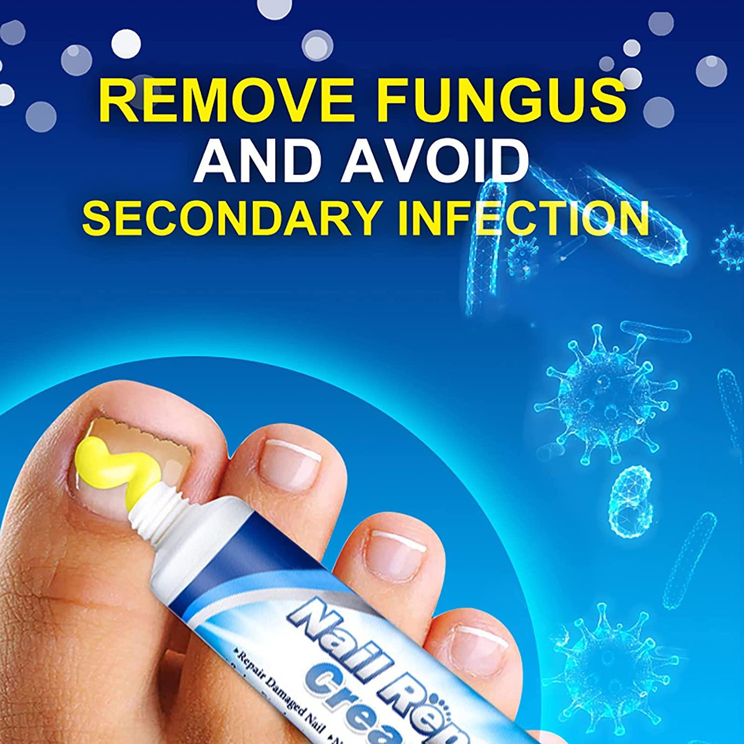 Maximum Strength Nail Repair Cream for Toenail Fungus Treatment 20g