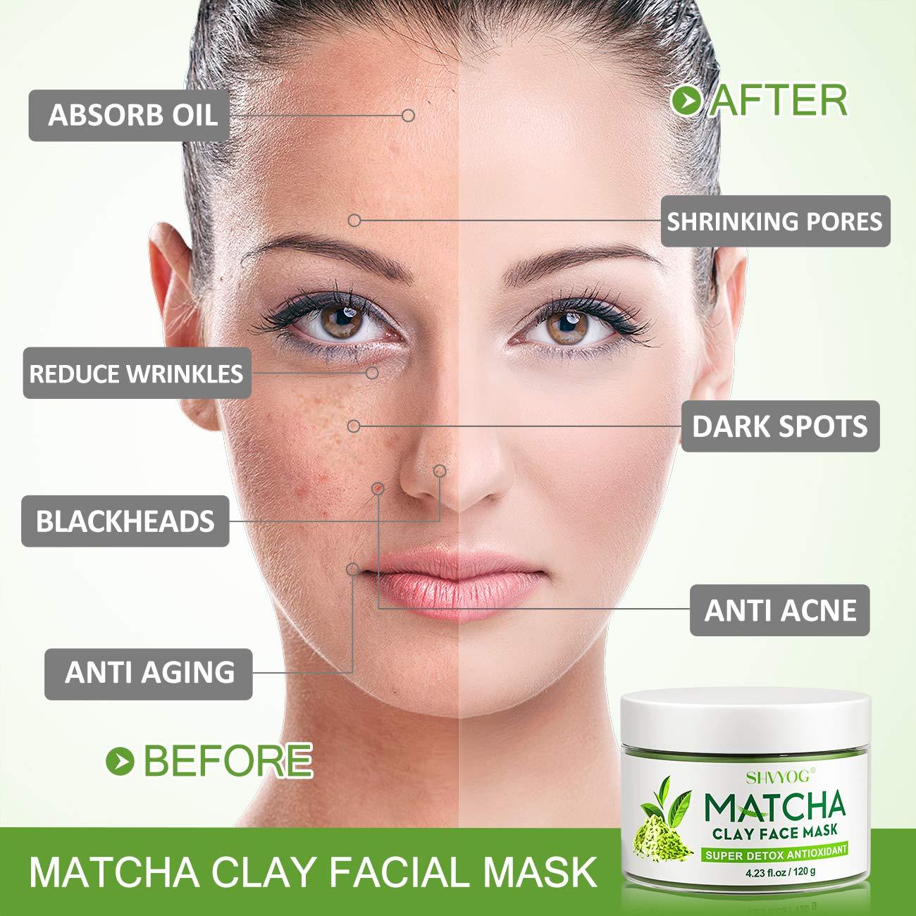 hoppe Gennemvæd enkemand SHVYOG Matcha Green Tea Face Mask, Antioxidant Green Tea Clay Mask with  Volcanic Mud, Deep Cleansing & Moisturizing & Hydrating Facial Clay Mask  for Acne, Blackheads, Pores, Wrinkles