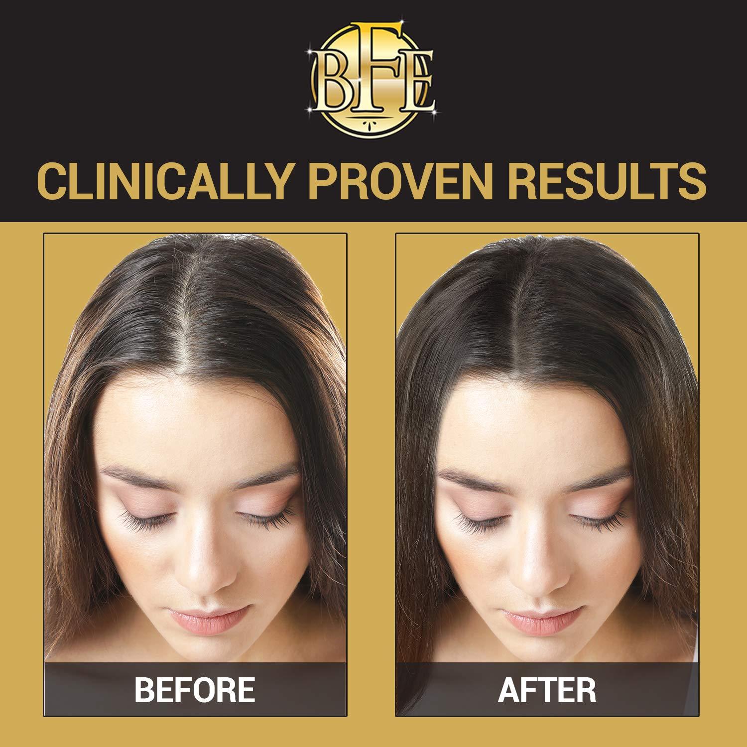 Hair Regrowth ShampooMaximum Strength DHT Blocker. Repairs