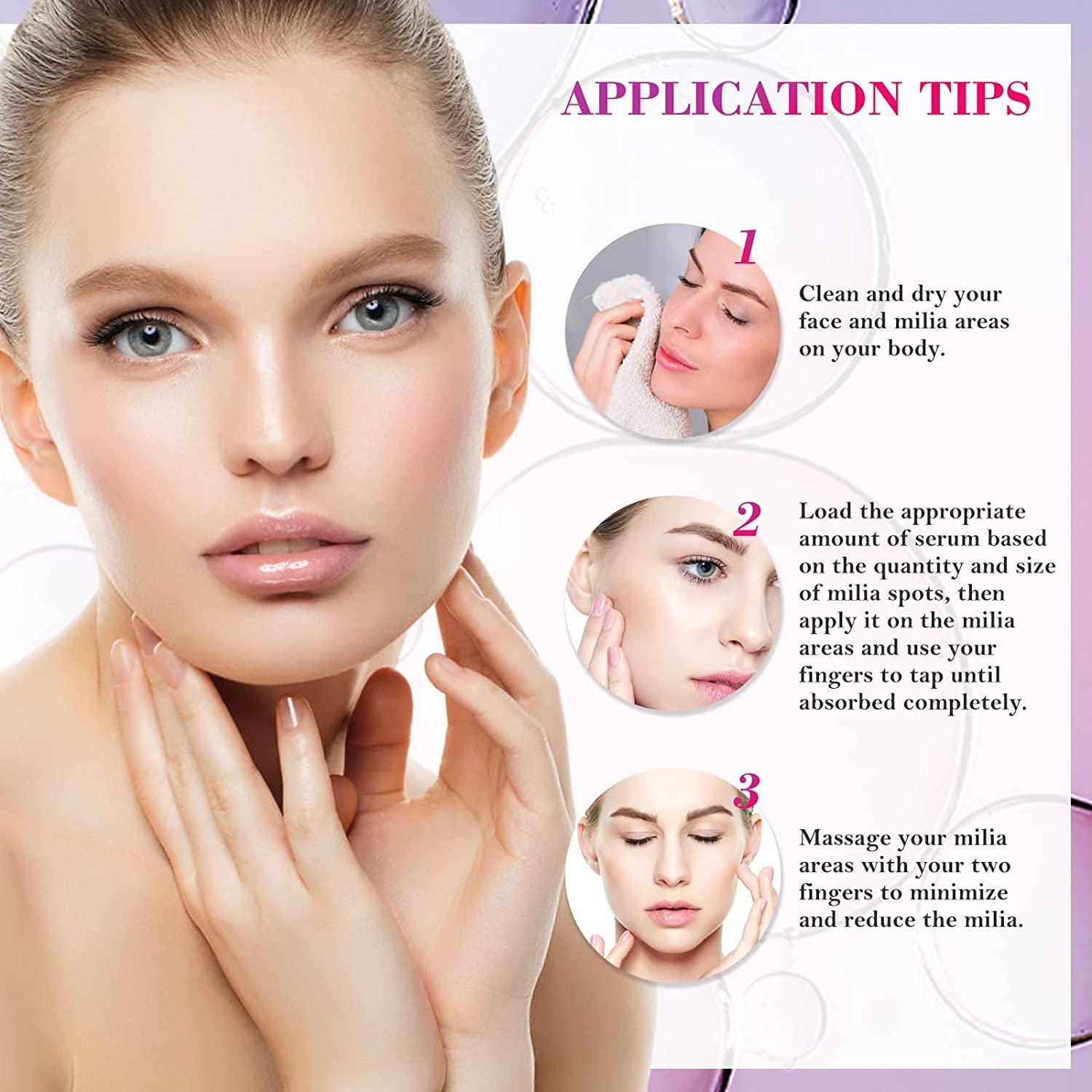 ZOHRAA Milia Remover Milia Spot Treatment Helps Dissolve and Reduce