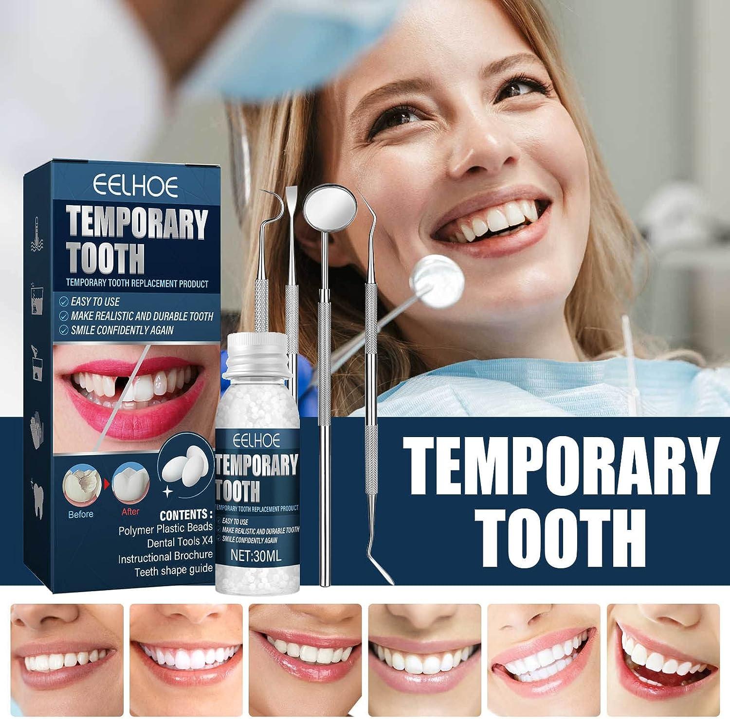 30ml Temporary Tooth Repair Kit, Temporary Filling Teeth Thermal Beads for  Filling Fix The Missing and Broken Tooth 