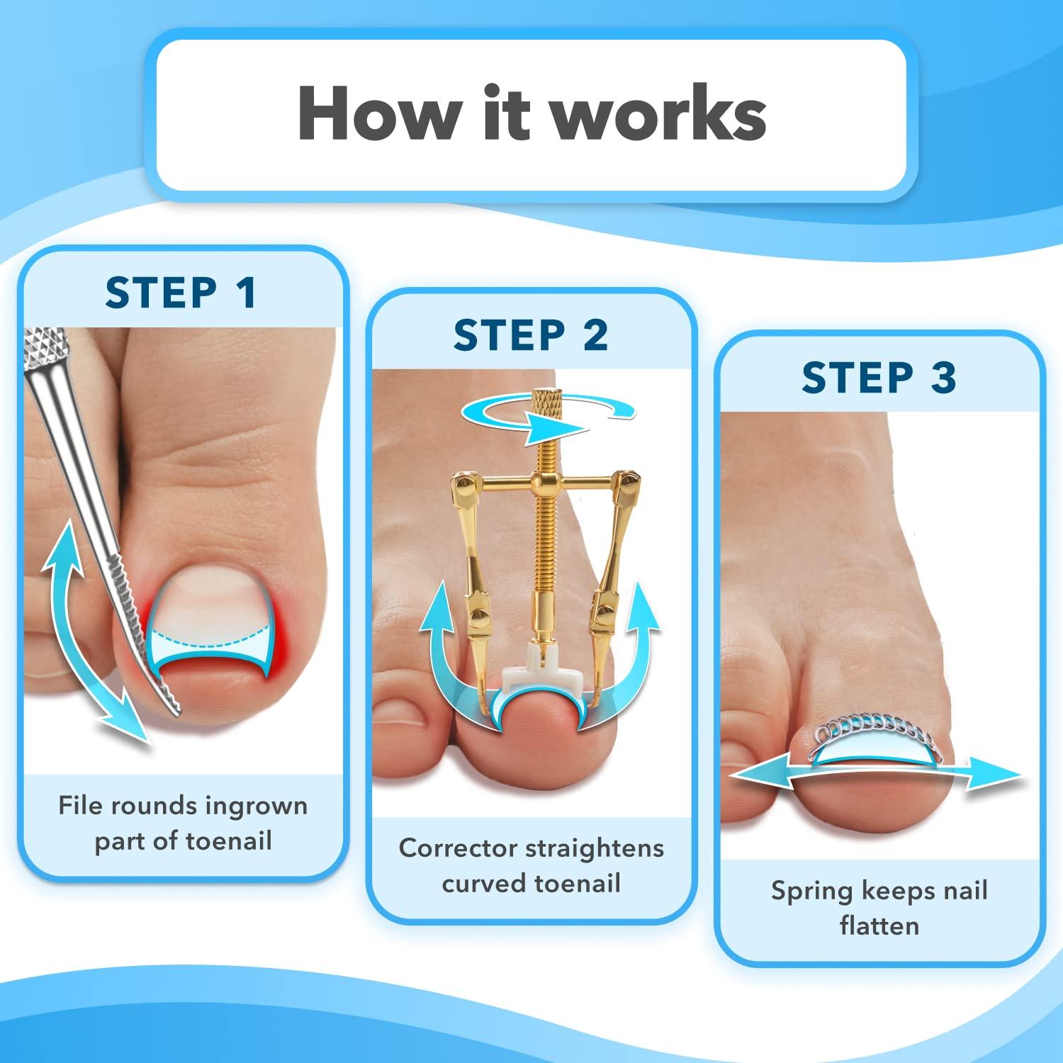 Dr. Krause 26 Pcs Ingrown Toenail Treatment Kit Includes 16 Podiatry