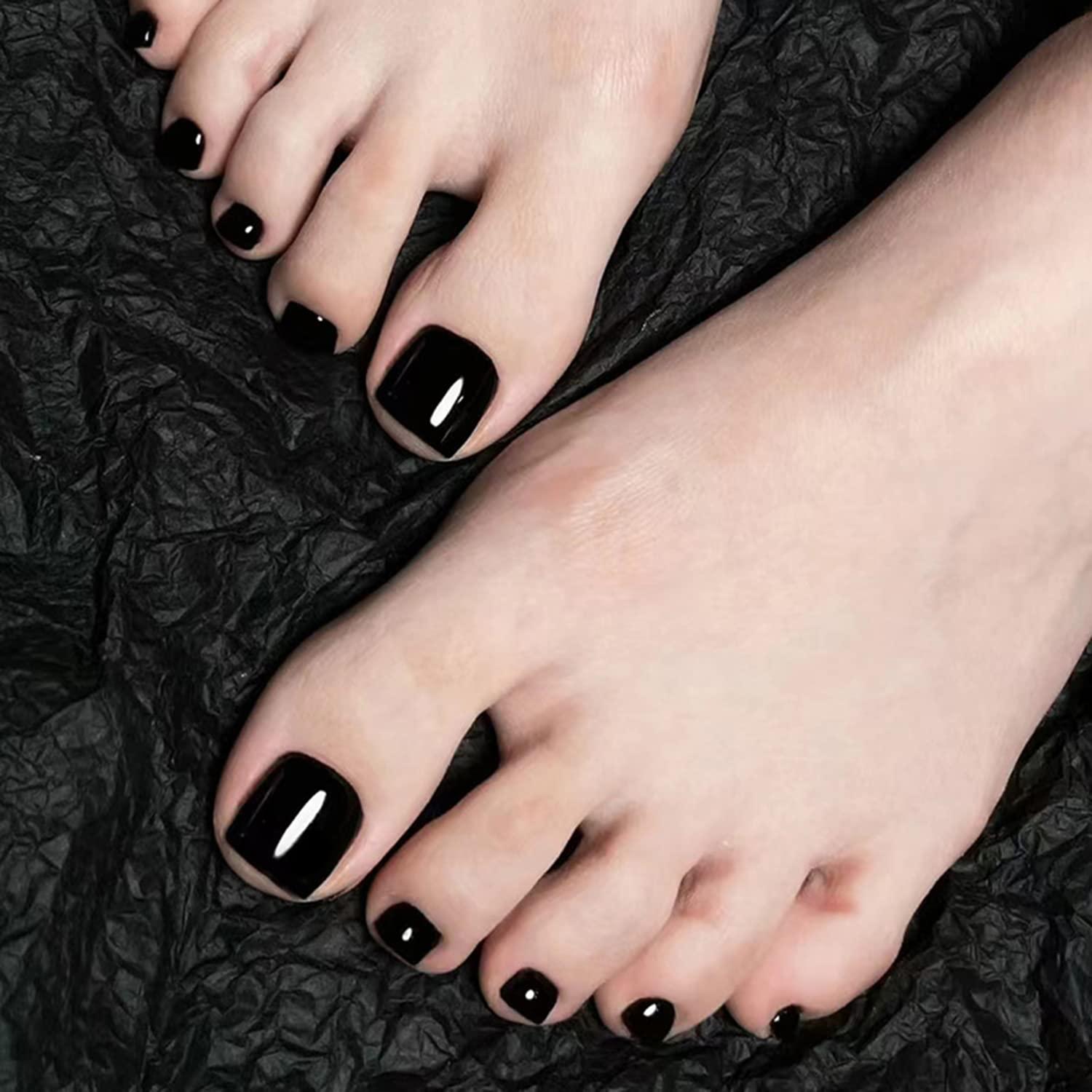 File:Toe nails black.jpg - Wikimedia Commons