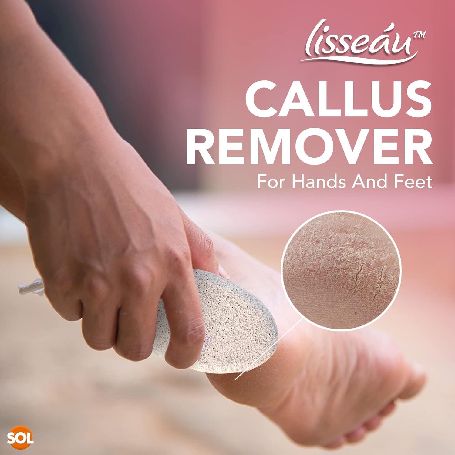 2pk Natural Pumice Stone for Feet Callus Remover Feet Scrubber Dead Skin Pumice Stones Foot