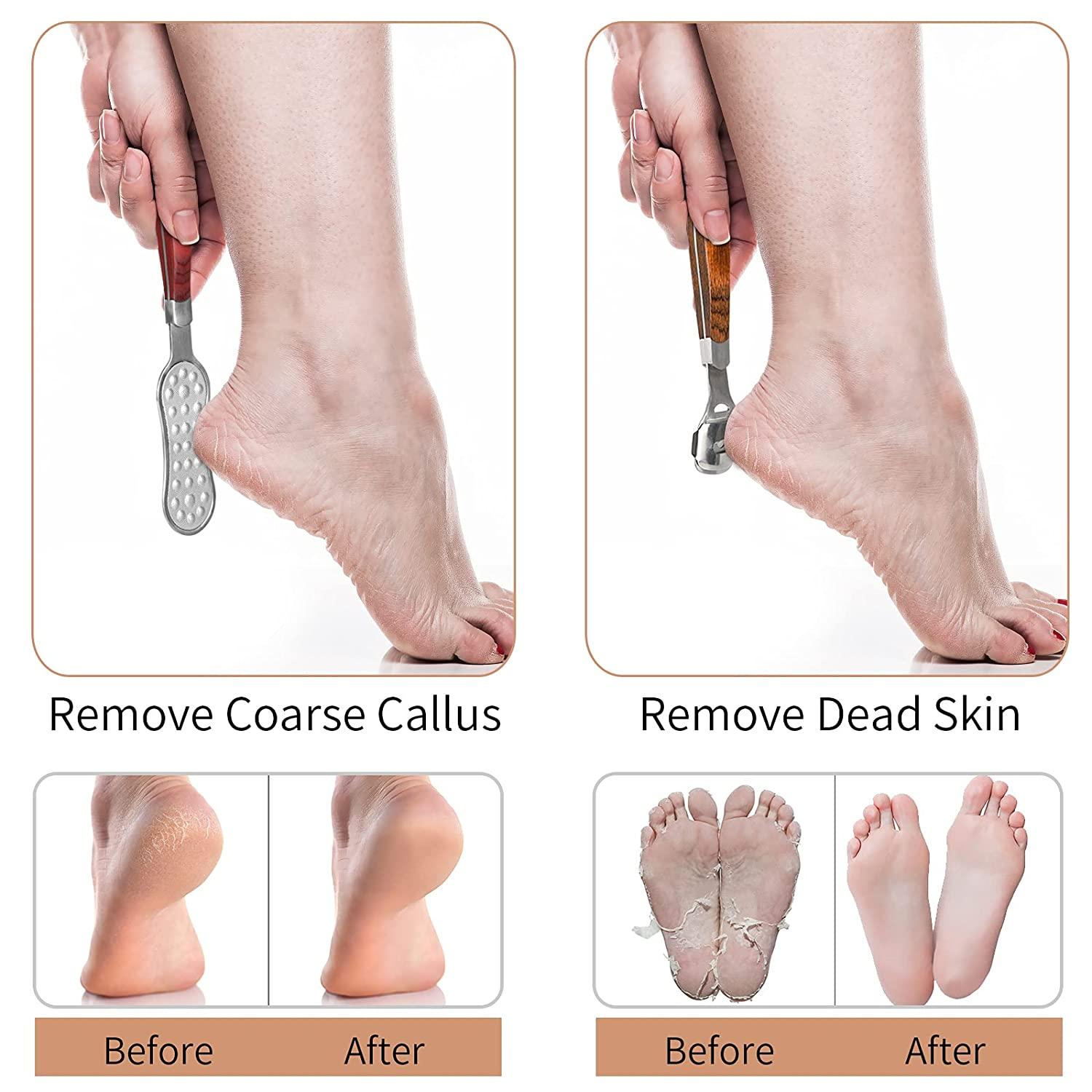 Callus Remover for Feet: Electric Foot Scrubber JTLMEEN Waterproof Pedicure  Tools Foot File Kit - Rechargeable Feet Scrubber Dead Skin Remover with  Adjustable Speed Remove Cracked Hard Skin Black
