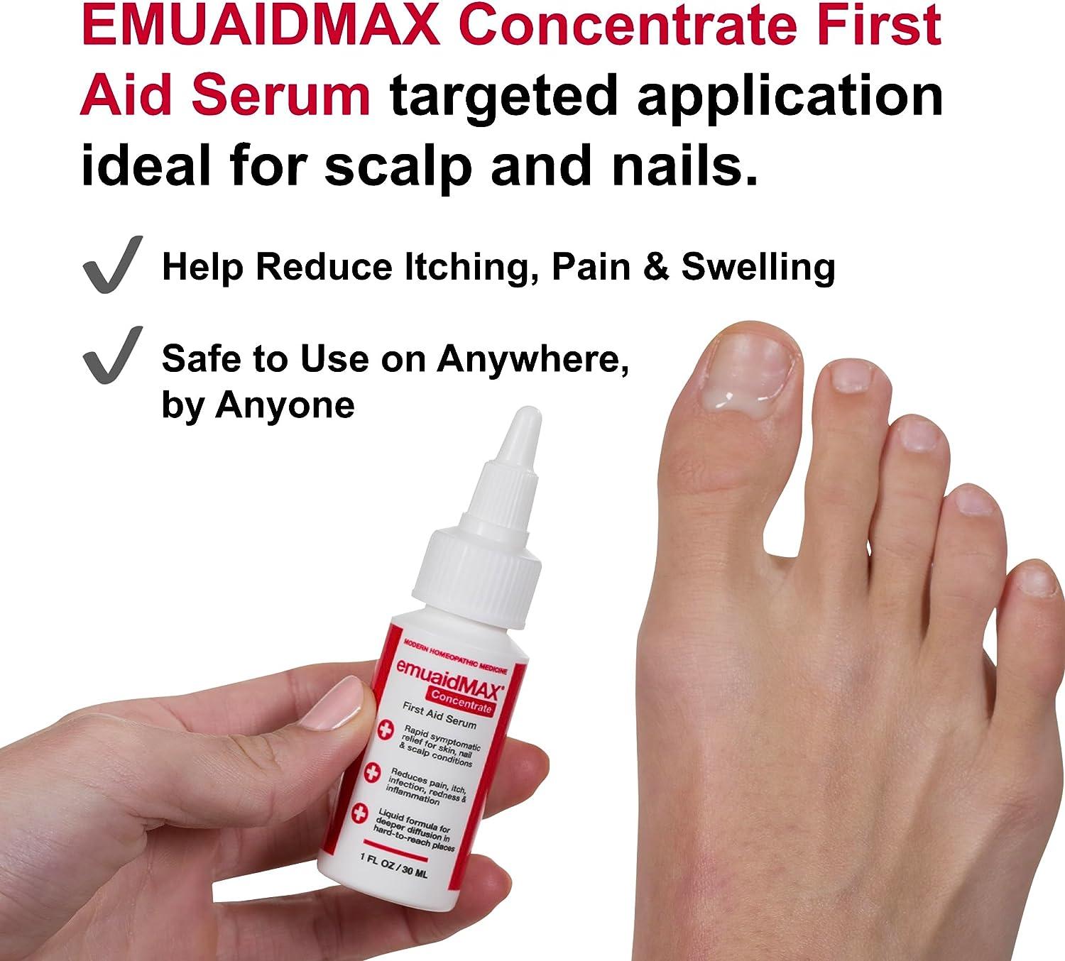 Nail Repair Liquid Anti Infection Paronychia Onychomycosis Nail Fungus  Removal Treatment Essence Feet Toe Nail Care Products - AliExpress