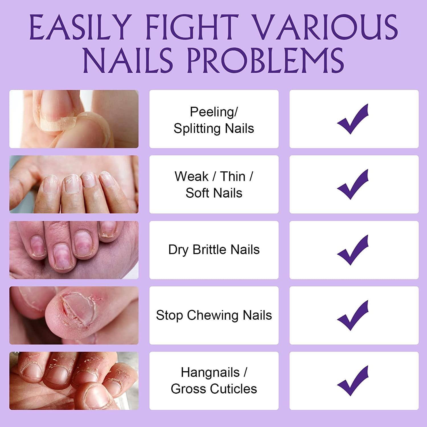 Easy ways to stop your nail polish chipping