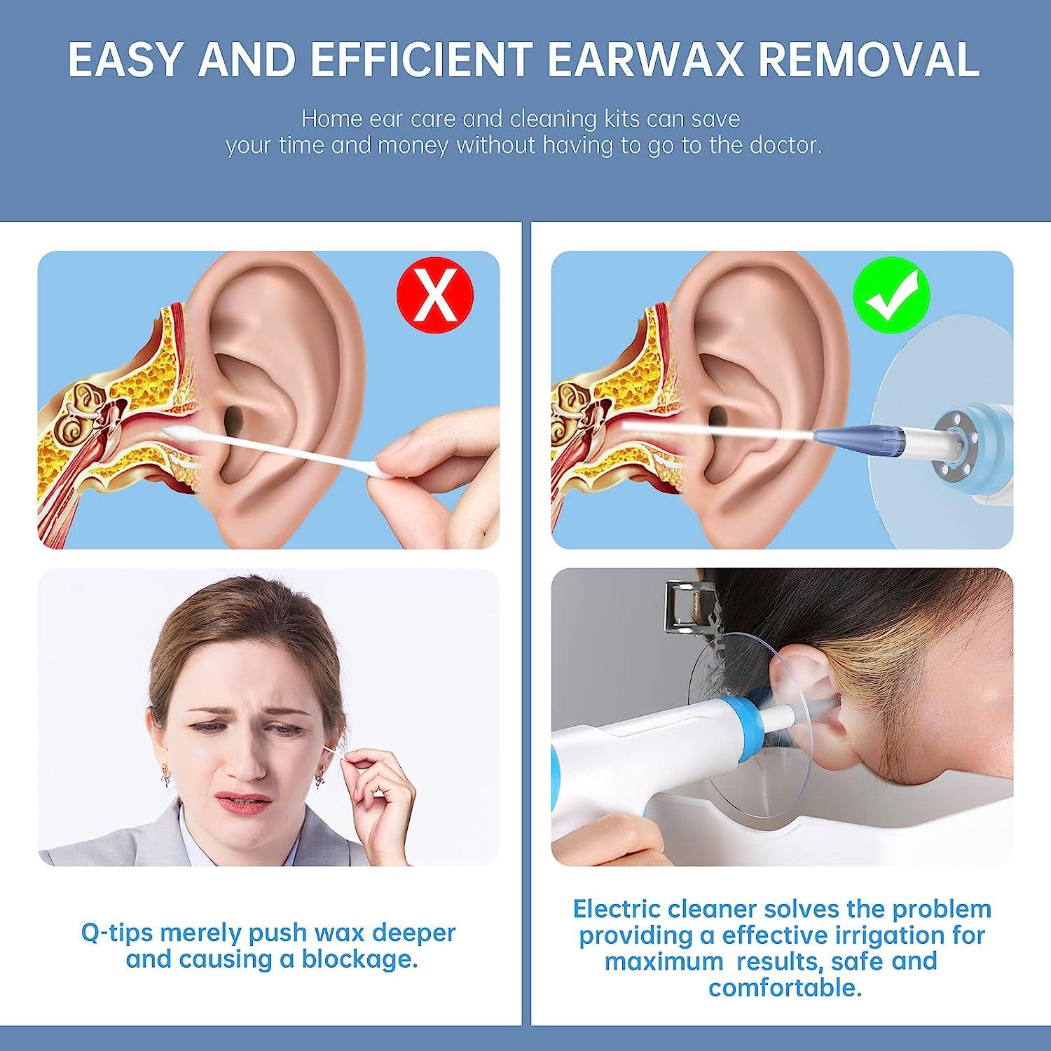 Electric Ear Wax Removal System with 15 Disposable Tips Earwax