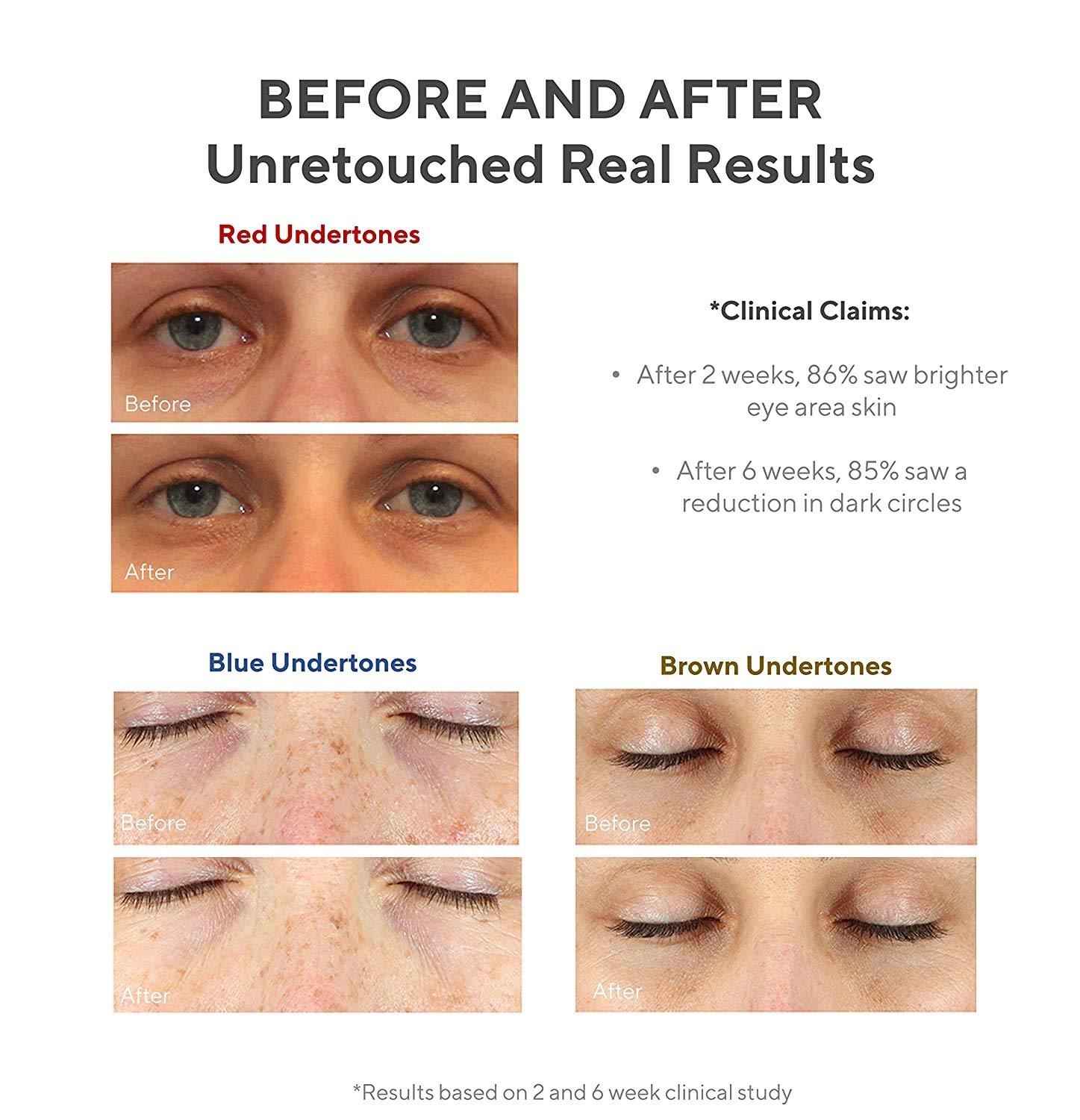 Murad Environmental Shield VitaC Eyes Dark Circle Corrector Vitamin C Brightening Serum