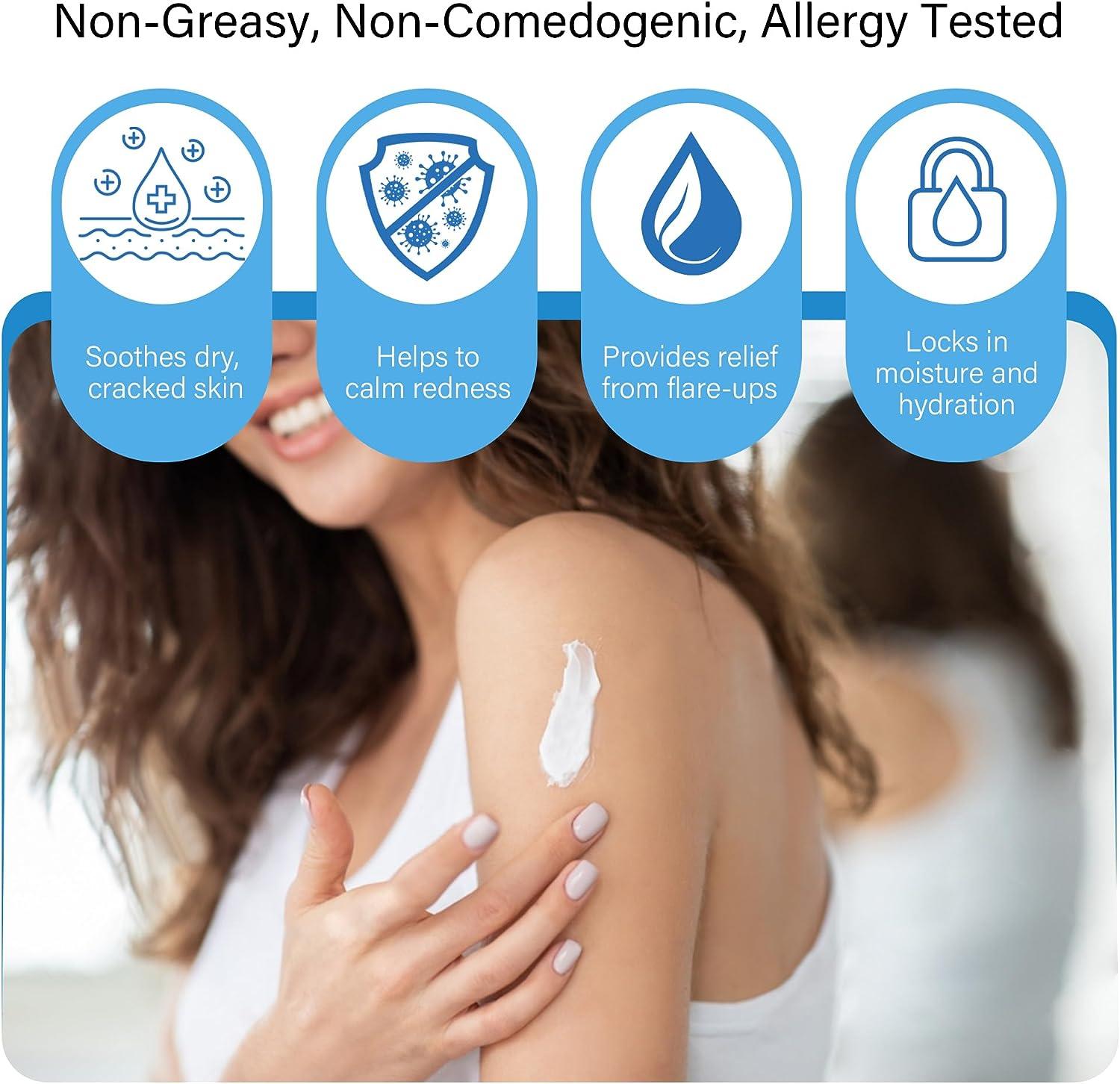 MEOLY Psoriasis Eczema Rosacea Cream 60 ML Anti-Itch Dry Skin