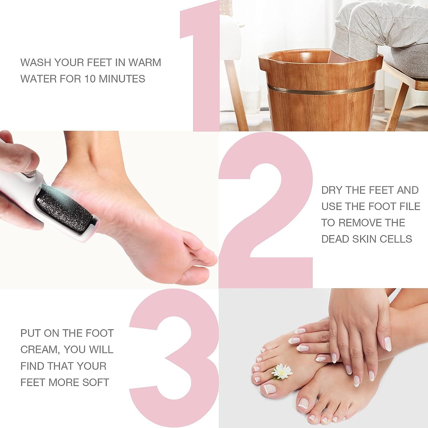 Powerful Electric Foot Callus Remover, Rechargeable Pedicure Tools Electric Foot File with Smart Light, Fine & Coarse Roller Heads, Am 8:00 Callus